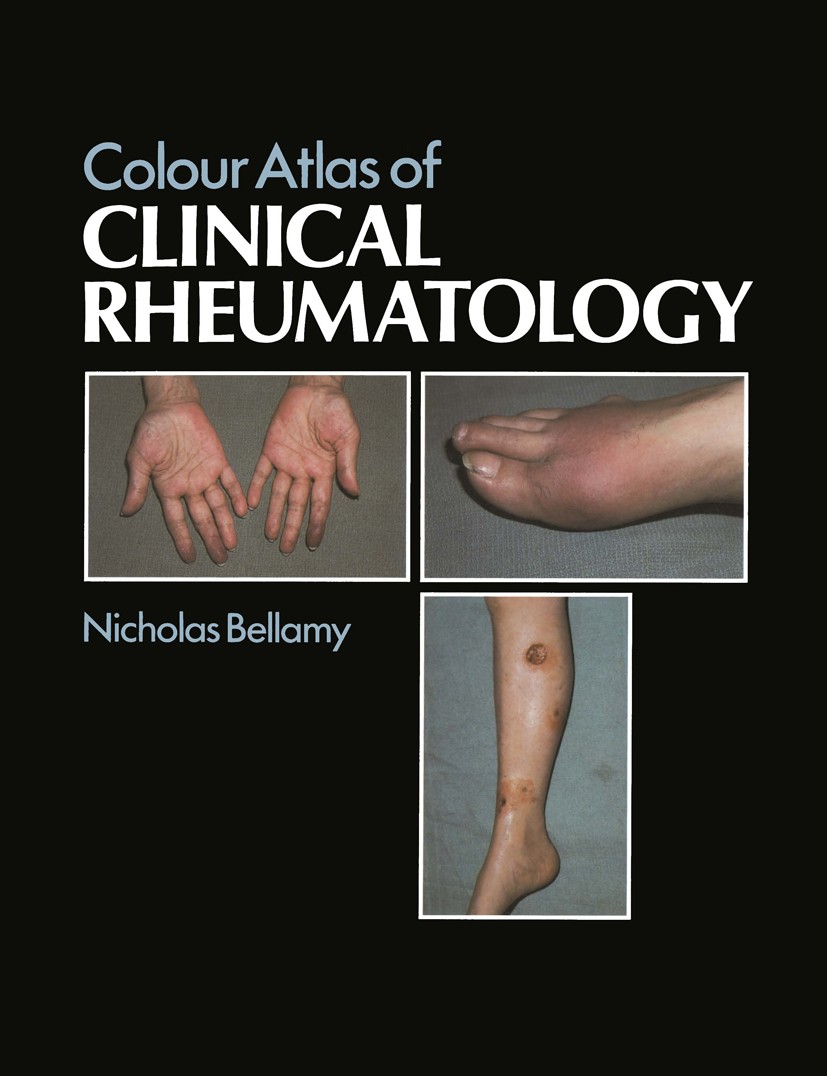健康・医学 A Colour Atlas of Rheumatoid Hand 健康・医学 A Colour Atlas of Rheumatoid Hand 1,529