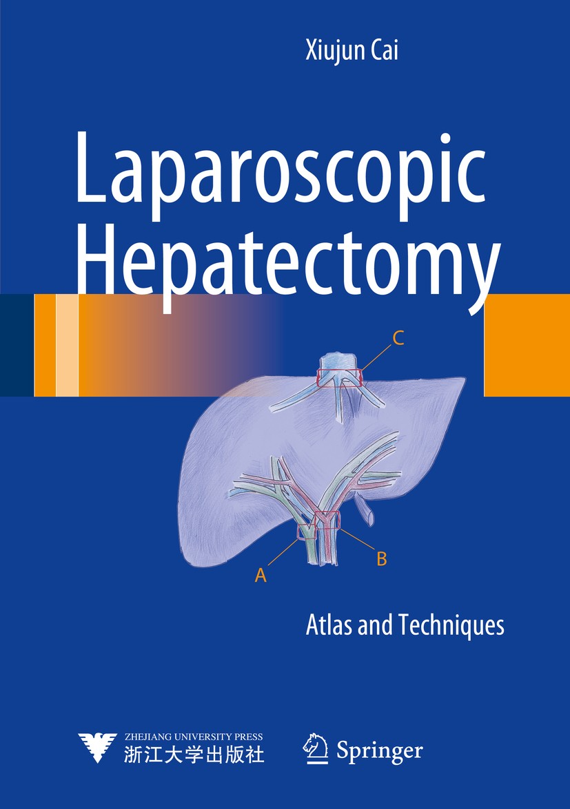 Controversies in Laparoscopic Surgery [ペーパーバック] Assalia， Ahmad? Gagner， Michel; Schein， Moshe Controversies in Laparoscopic Surgery : Assalia, Ahmad