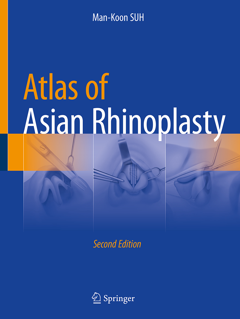 Atlas of Asian Rhinoplasty | SpringerLink