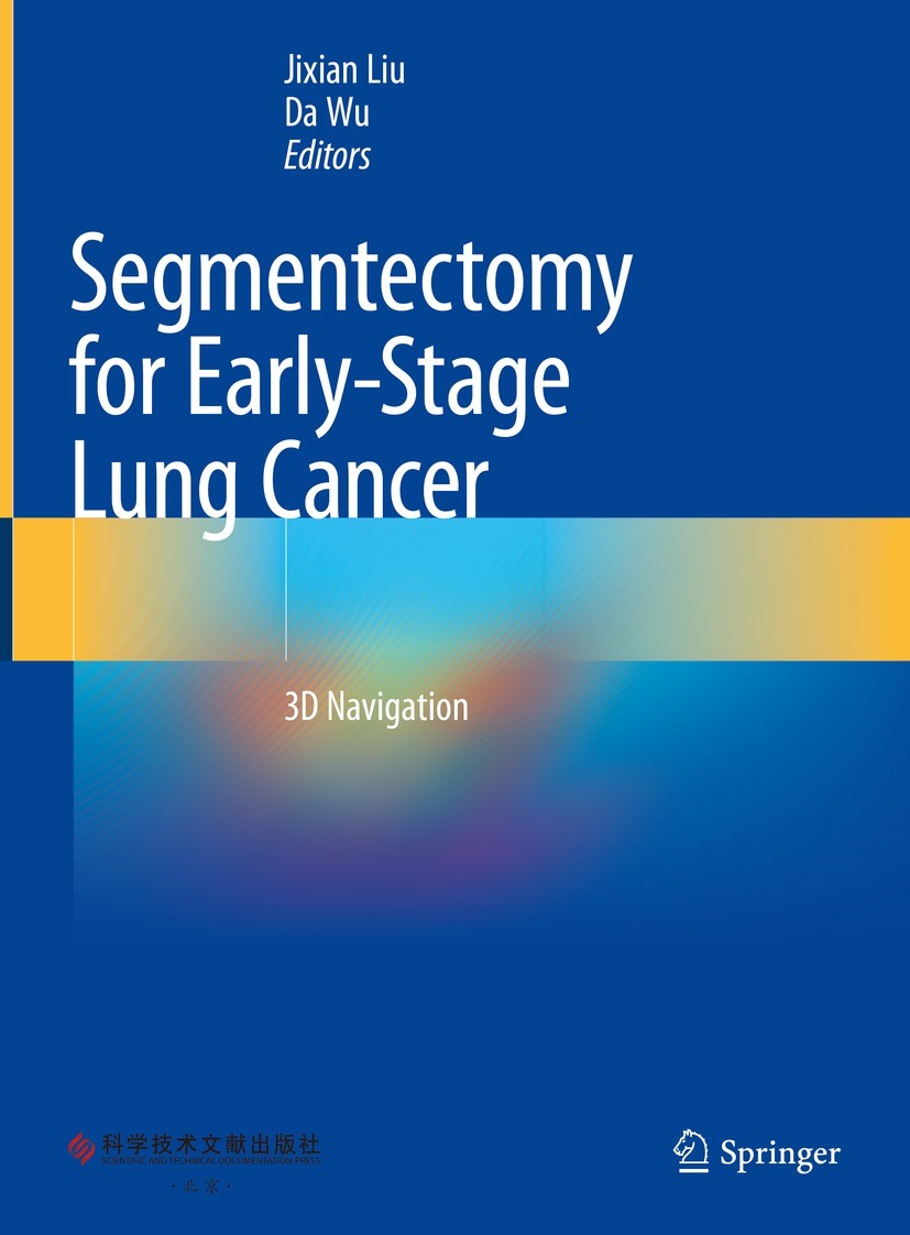 Segmentectomy for Early-Stage Lung Cancer: 3D Navigation Segmentectomy for Early-Stage Lung Cancer: 3D Navigation