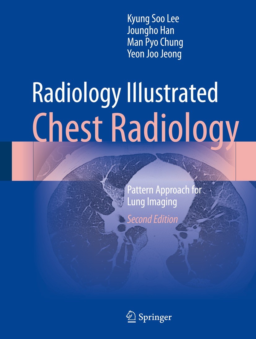 Radiology Illustrated Chest Radiology Pattern Approach for Lung