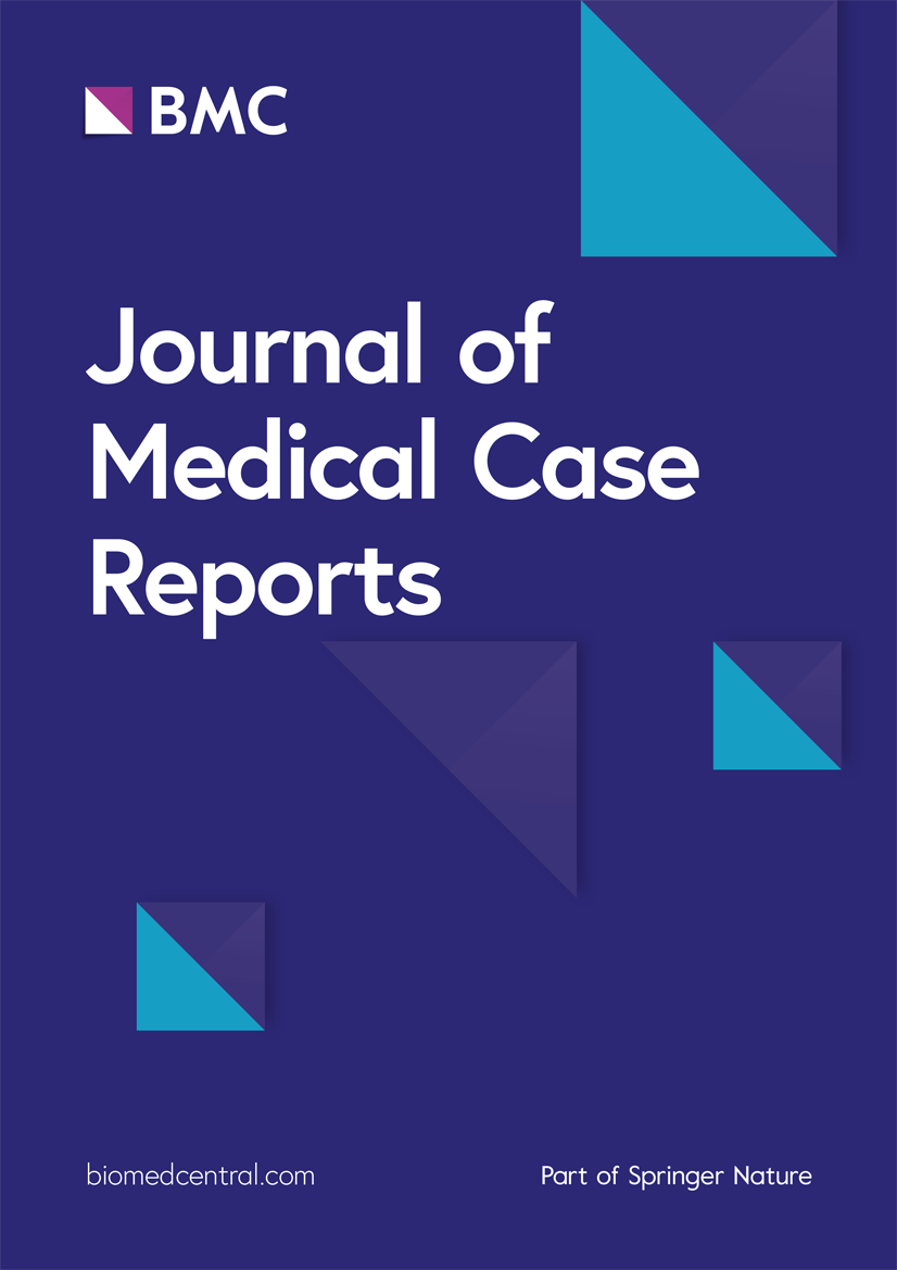 jmedicalcasereports.biomedcentral.com