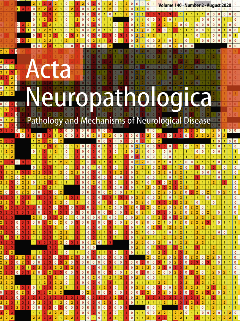 Reply: pineal parenchymal tumors of intermediate differentiation: in need of a stringent ...