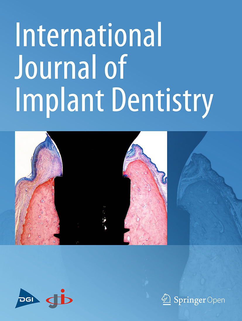 International Journal of Implant Dentistry International Journal of