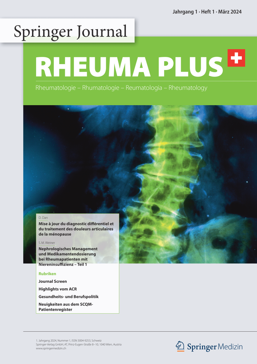  How I Treat Arthrose Rheuma Plus Schweiz