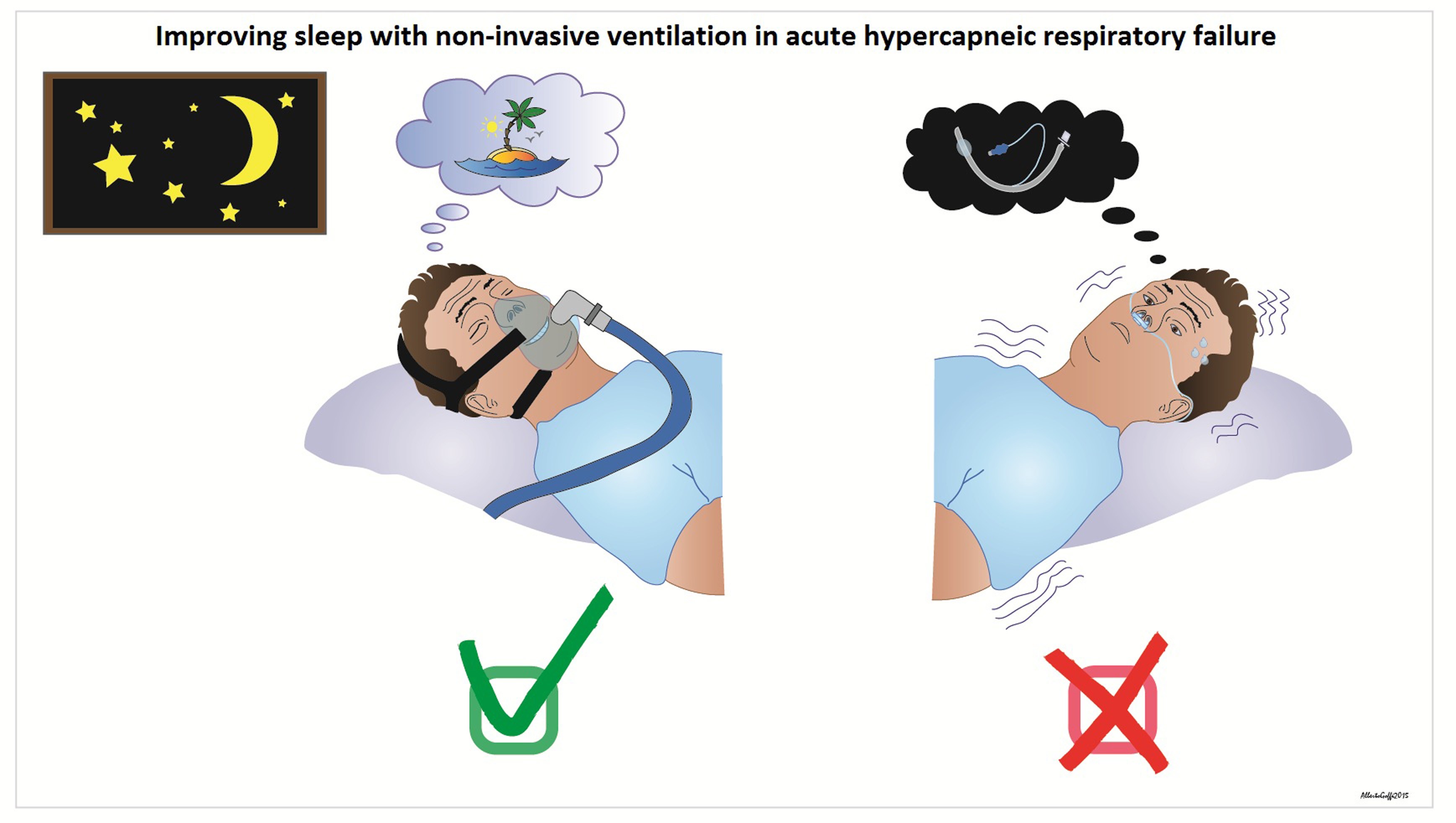 Positive and negative effects of mechanical ventilation on sleep in the  ICU: a review with clinical recommendations | SpringerLink