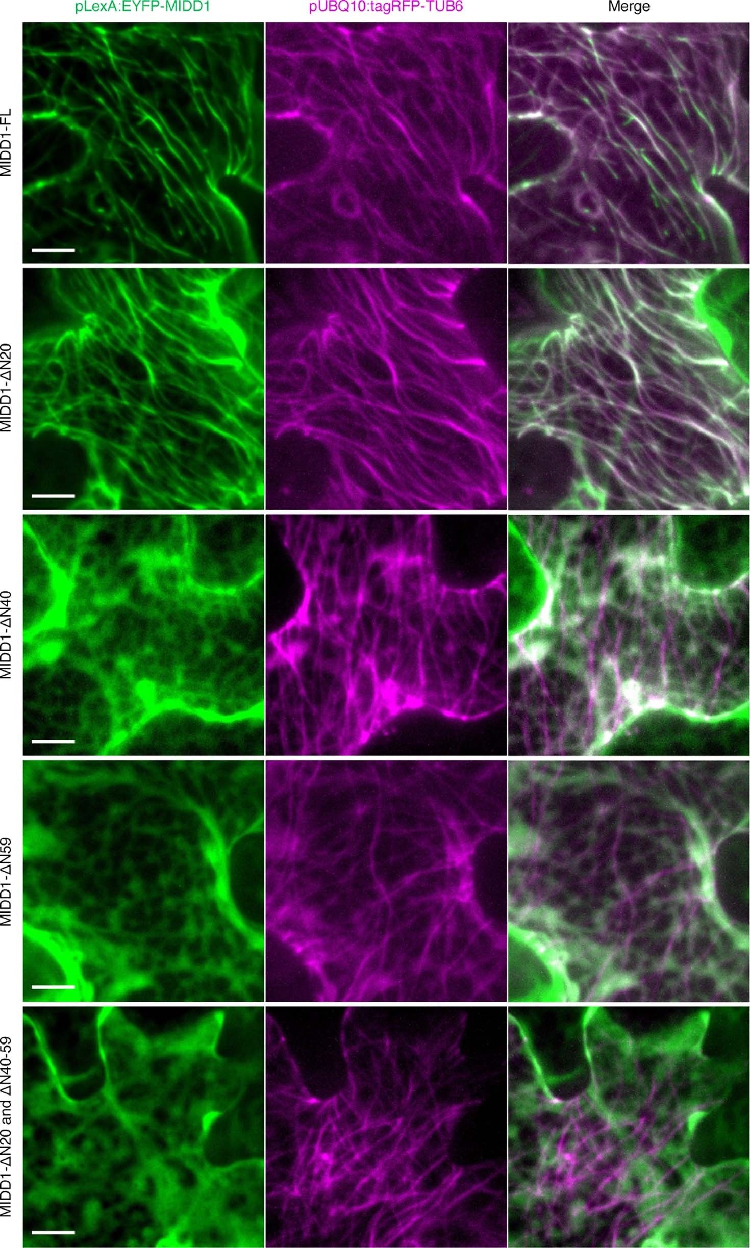 Extended Data Fig. 8: Localization of IDR-truncated MIDD1 in tobacco leaves.