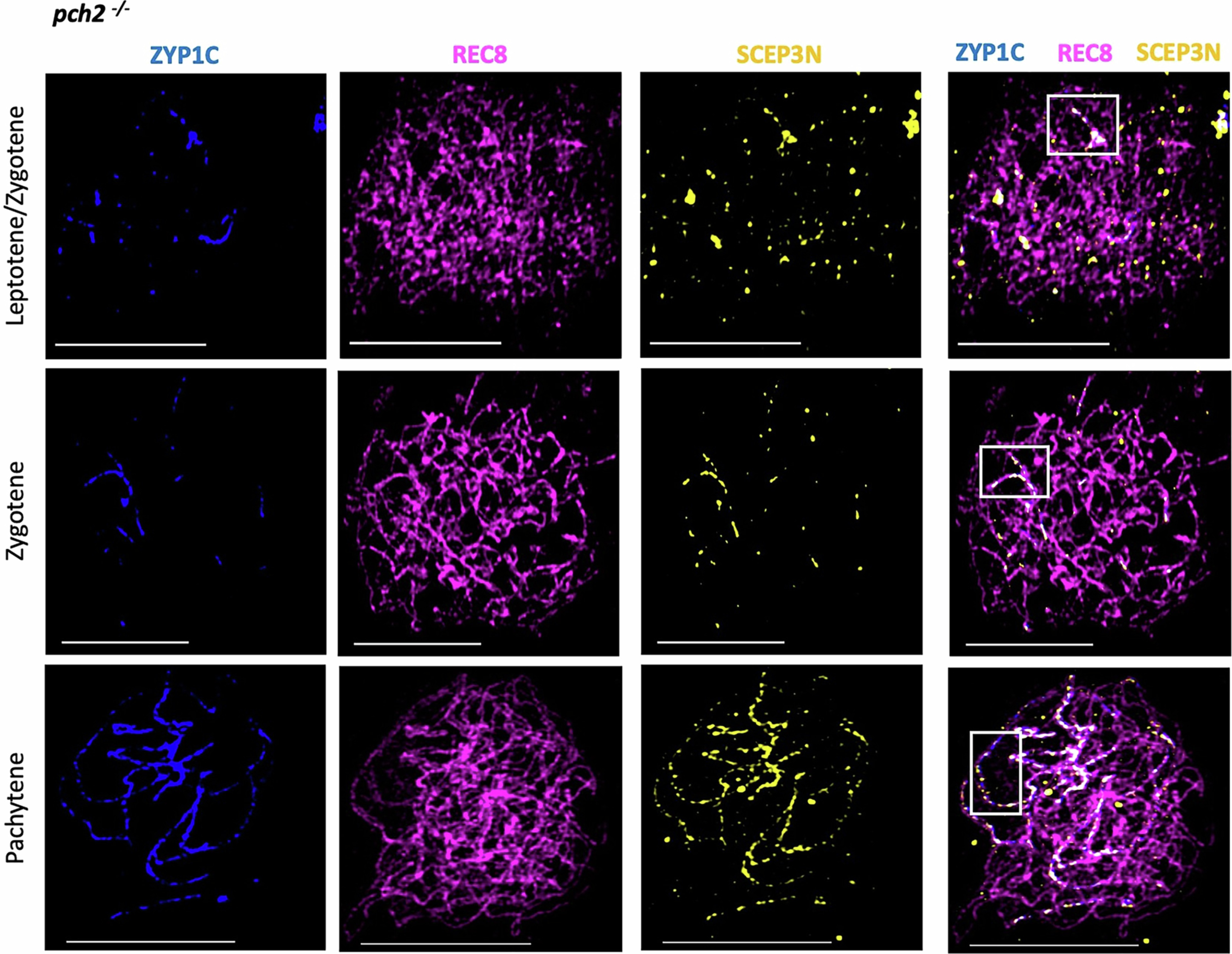 Extended Data Fig. 7: In the pch2 mutant short stretches of ZYP1 co-localise with evenly distributed SCEP3 foci.