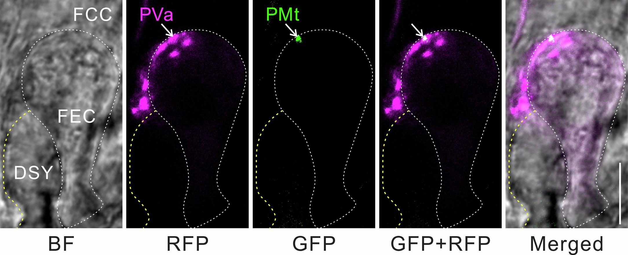 Extended Data Fig. 10: The colocalization of paternal mitochondrion and vacuole in the fertilized egg cell.