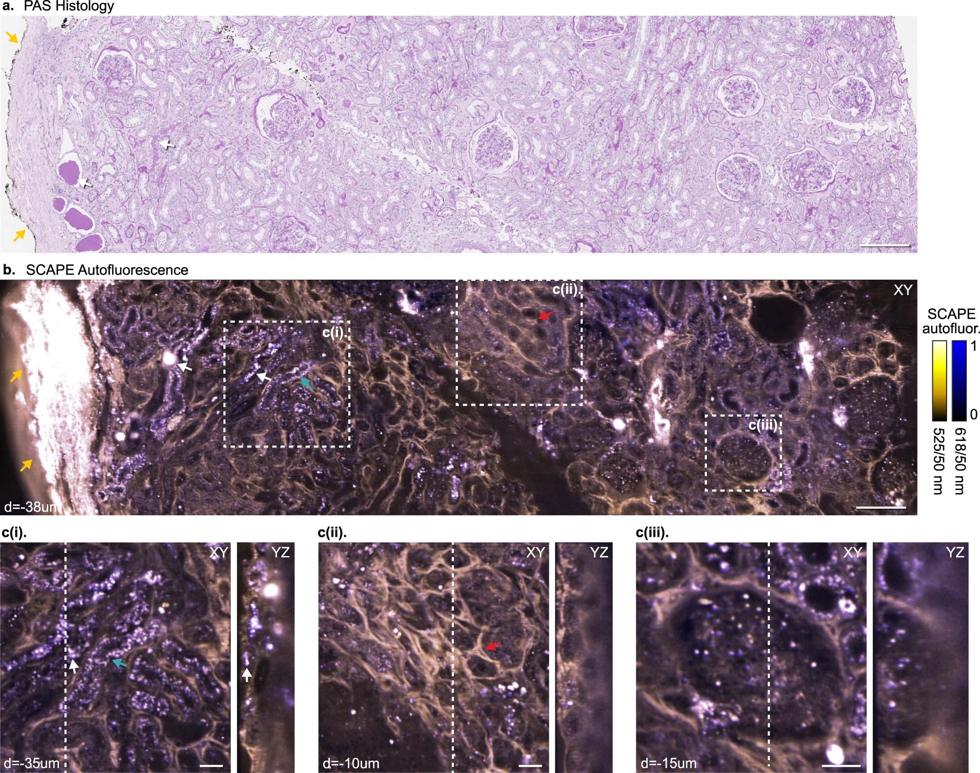 Extended Data Fig. 3: Autofluorescence in diabetic human kidney tissue imaged with MediSCAPE.