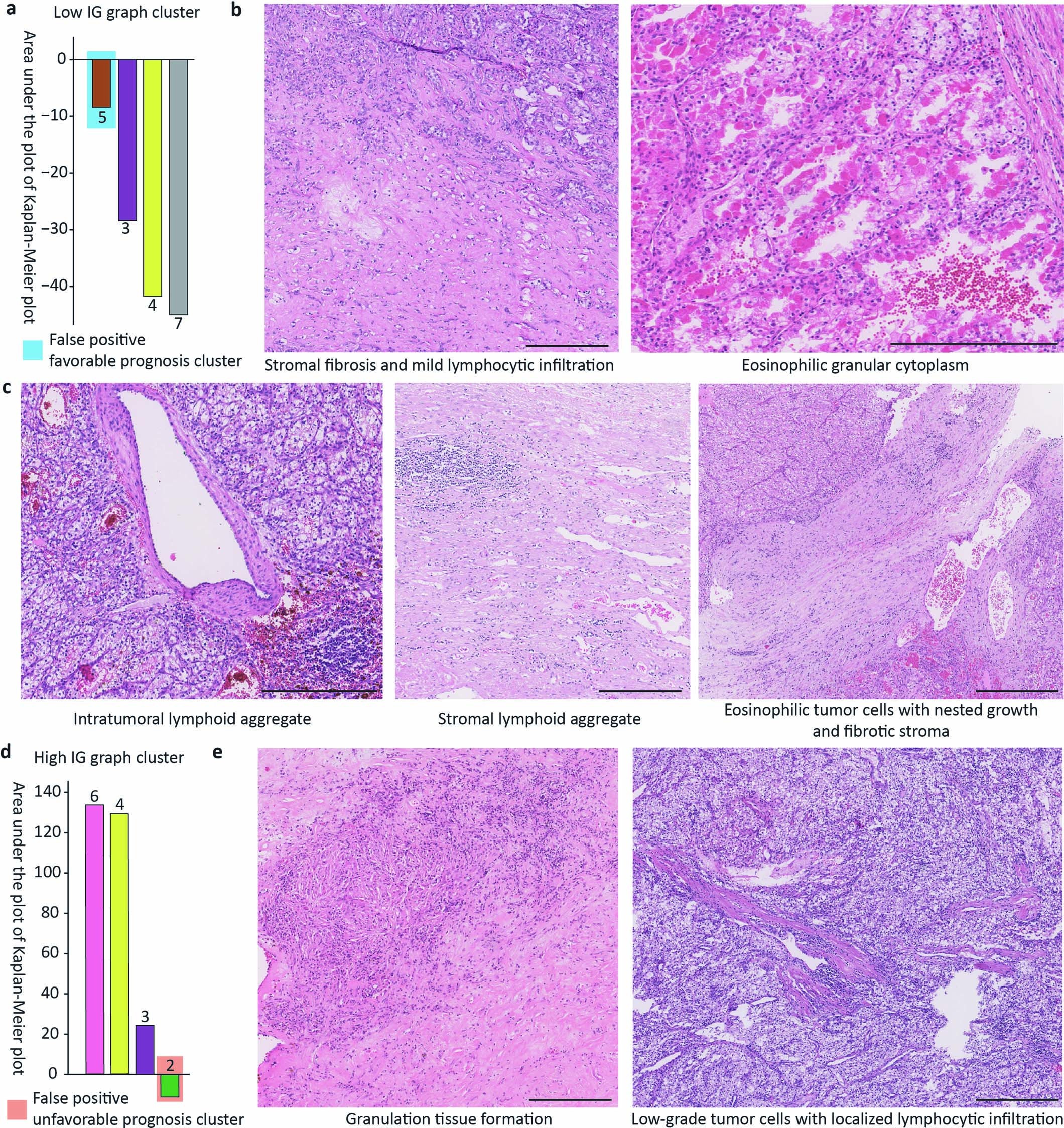 Extended Data Fig. 10: Pathological features of each IG group misclassified by TEA-graph.