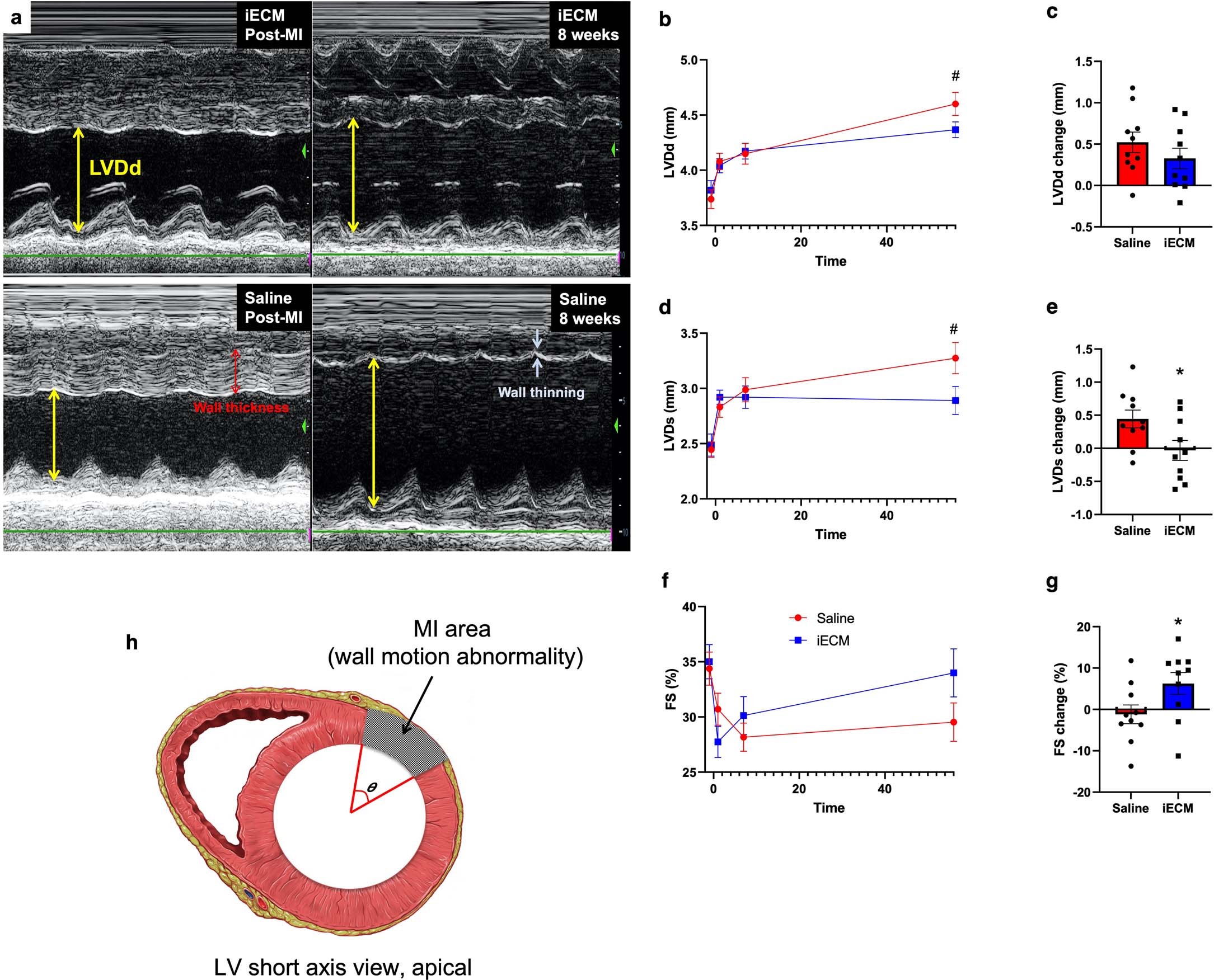 Extended Data Fig. 4: Additional echocardiography results showing that iECM infusions mitigate negative LV remodelling in a pig acute MI model.