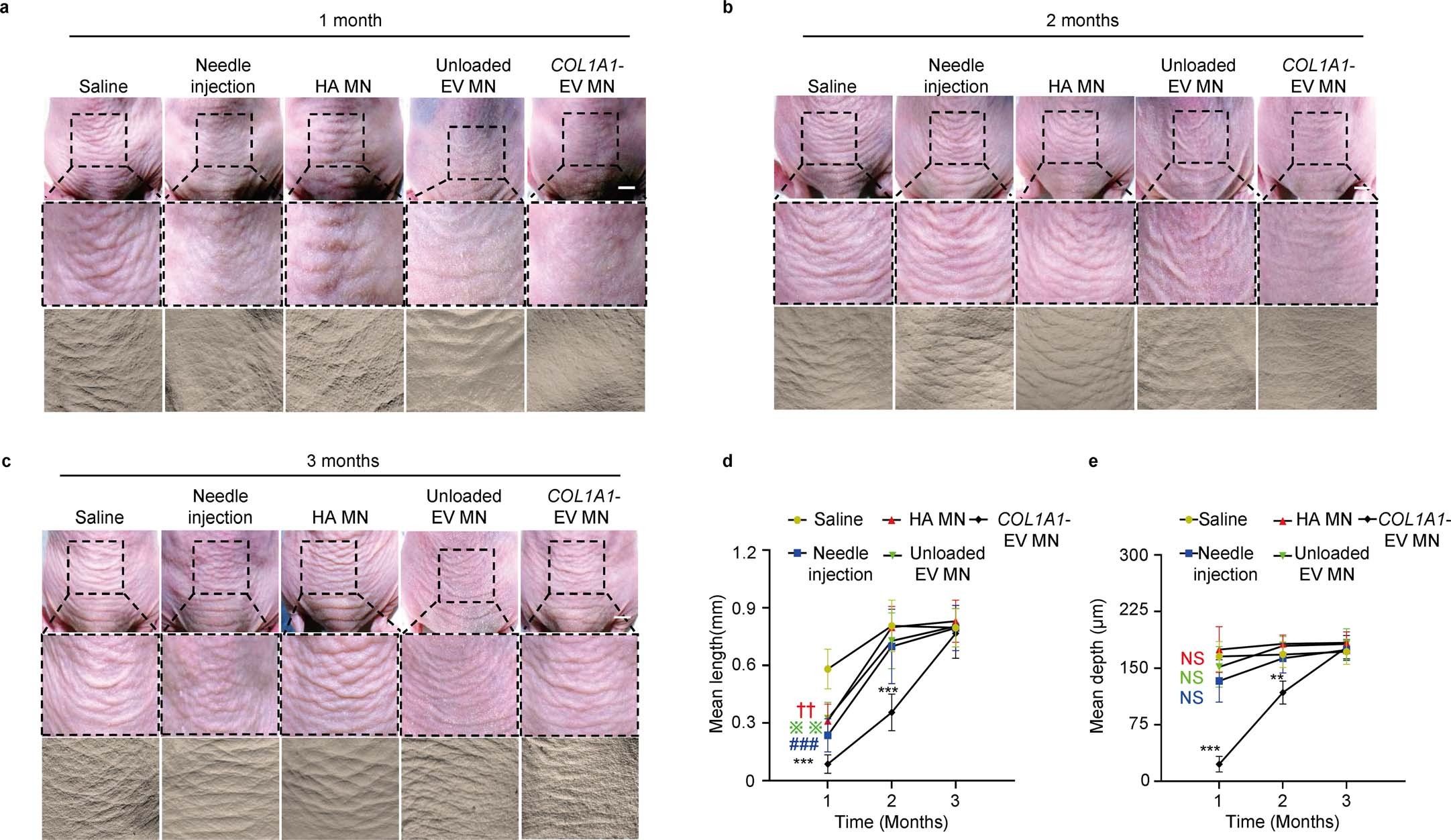 Extended Data Fig. 5: Evaluation of long term COL1A1-EV MN dermal wrinkle treatment by skin replica plaster.