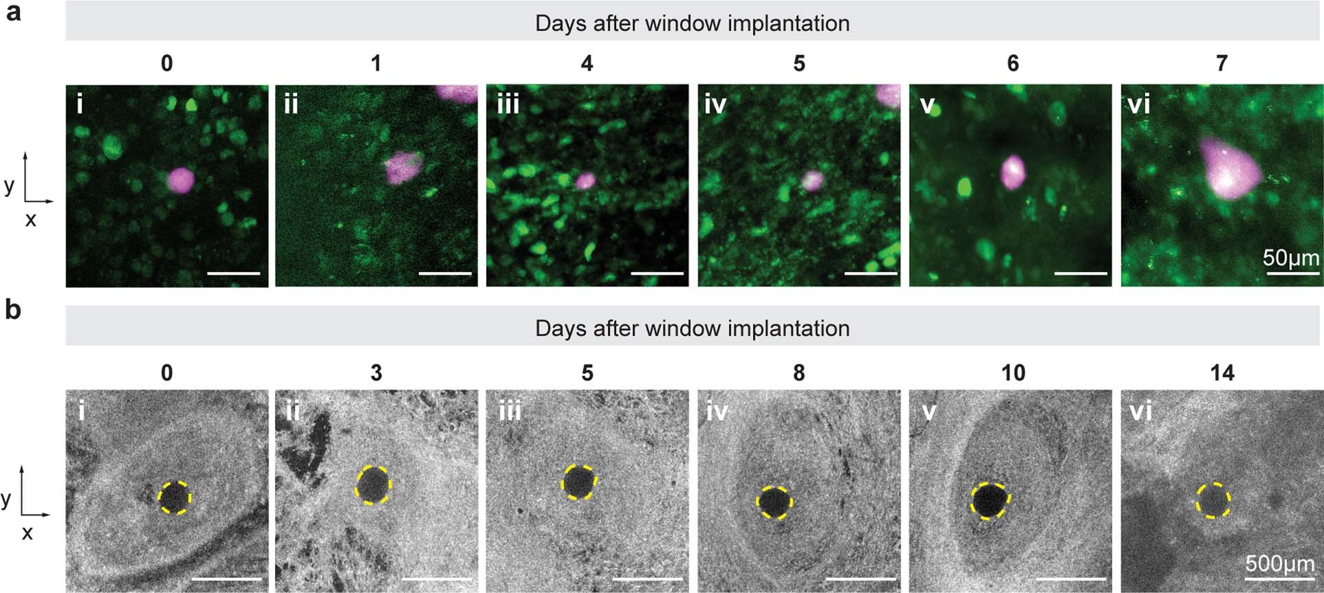 Extended Data Fig. 2: Longitudinal in vivo imaging of MCa-M3C-H2B-dendra2 tumours at the cellular and tissue scale.