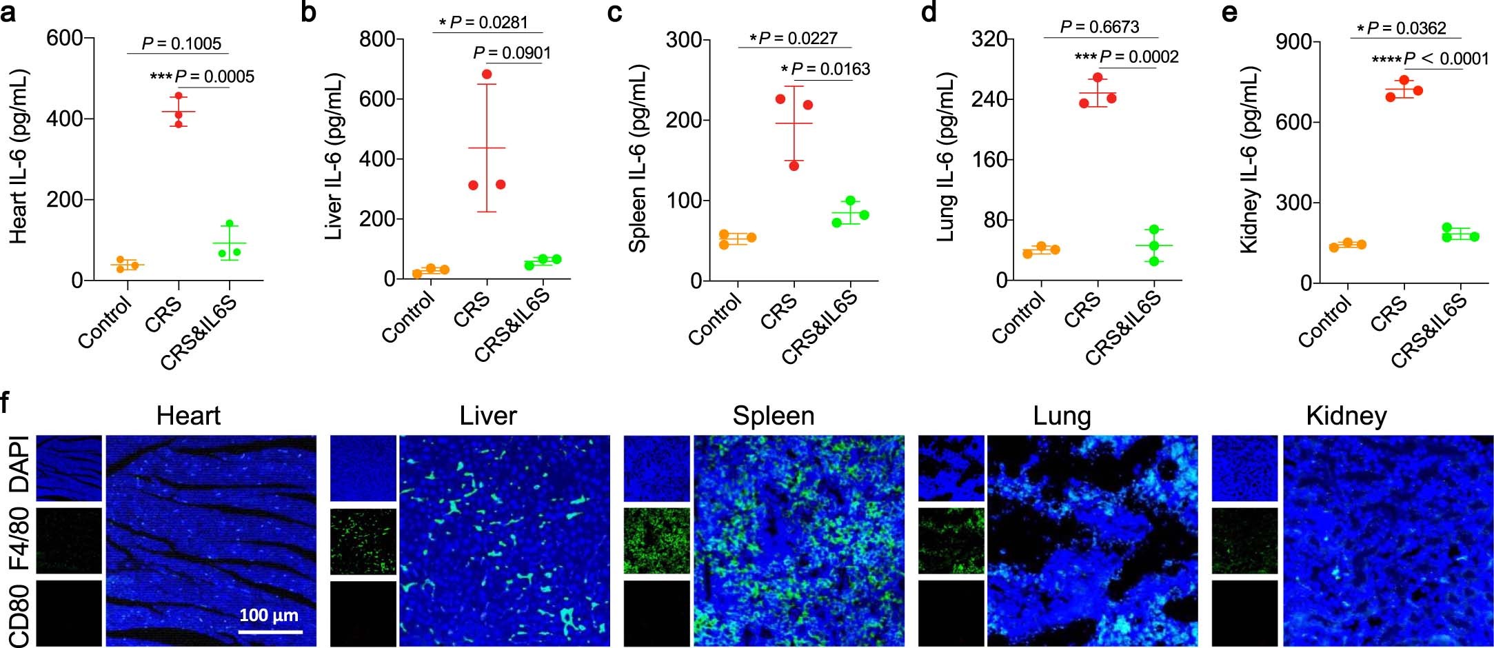 Extended Data Fig. 4: IL6S decreases IL-6 levels in major organs in a CAR-T-cell-induced CRS model.