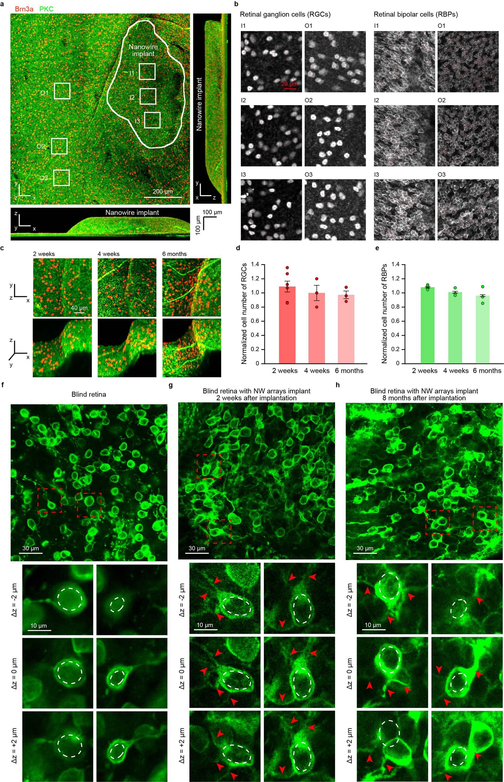 Extended Data Fig. 8: Biocompatibility and dendritic structural analysis of implants in mice.
