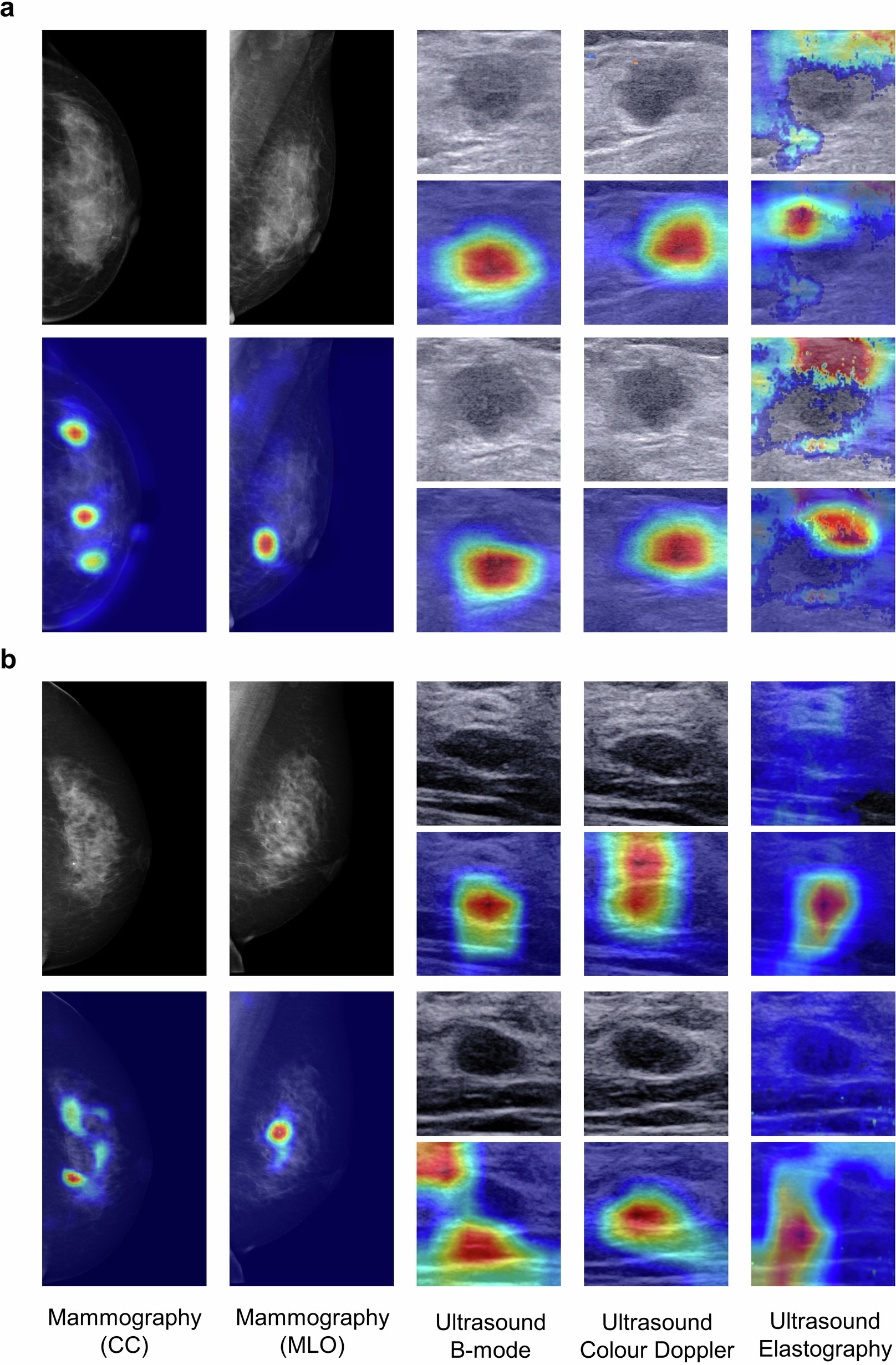 Extended Data Fig. 8: Examples of AI prediction basis.