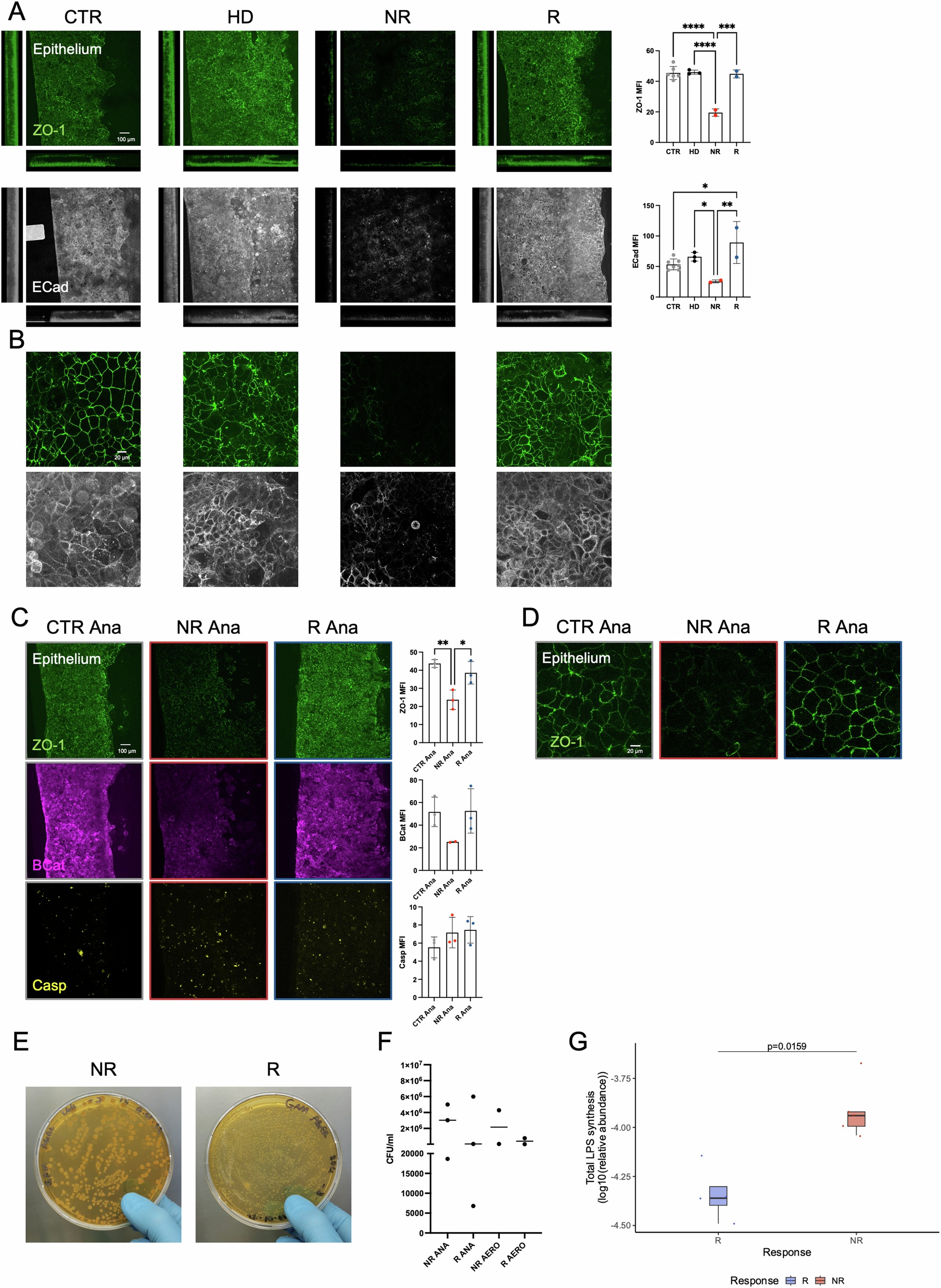 Extended Data Fig. 6: Differences between responsive and non-responsive patients hold in comparison with faecal material from healthy donors and in anaerobic conditions.