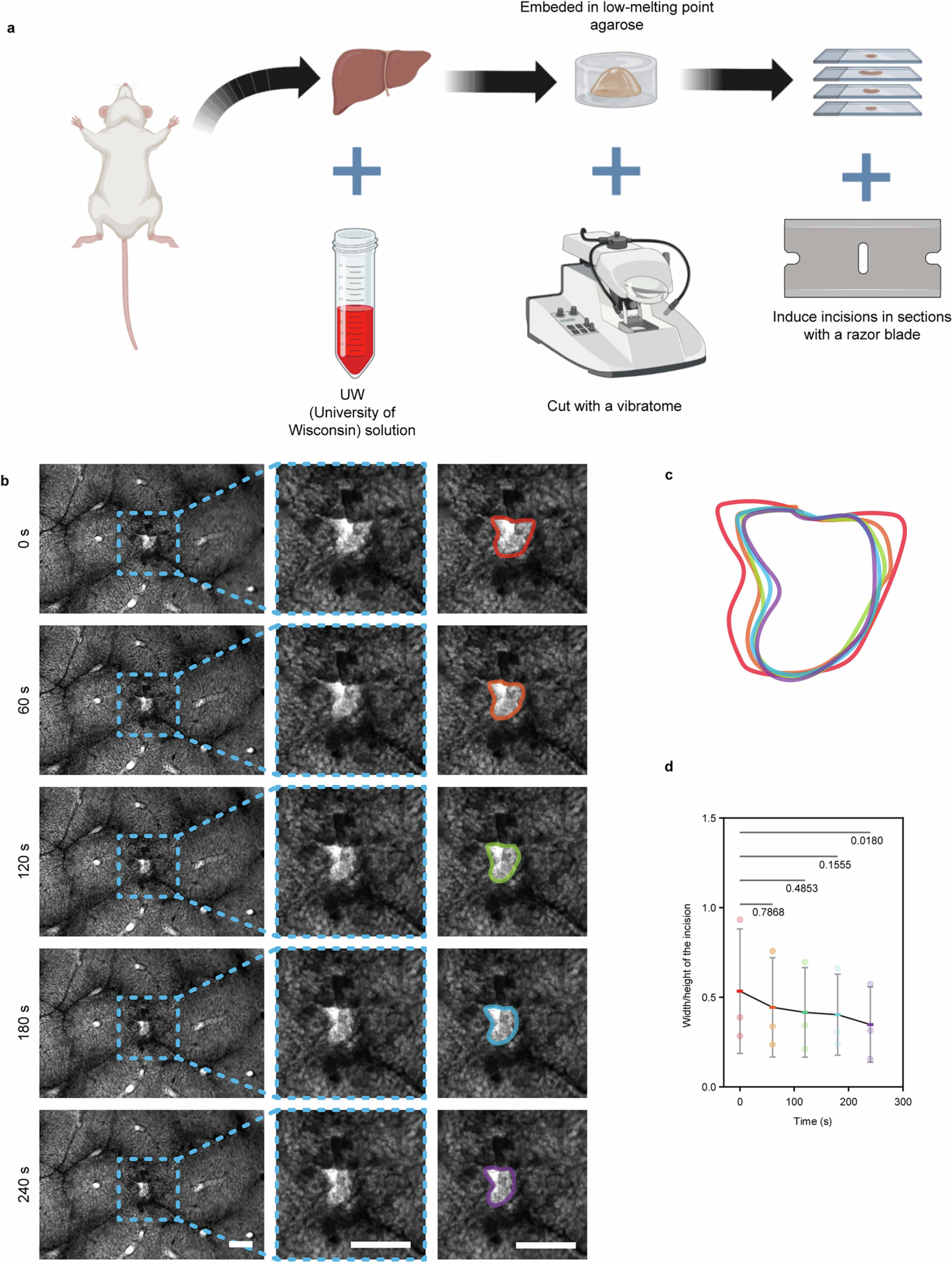 Extended Data Fig. 6: Alive liver sections of mouse indicate tension in the center of ‘portal to portal’ direction.