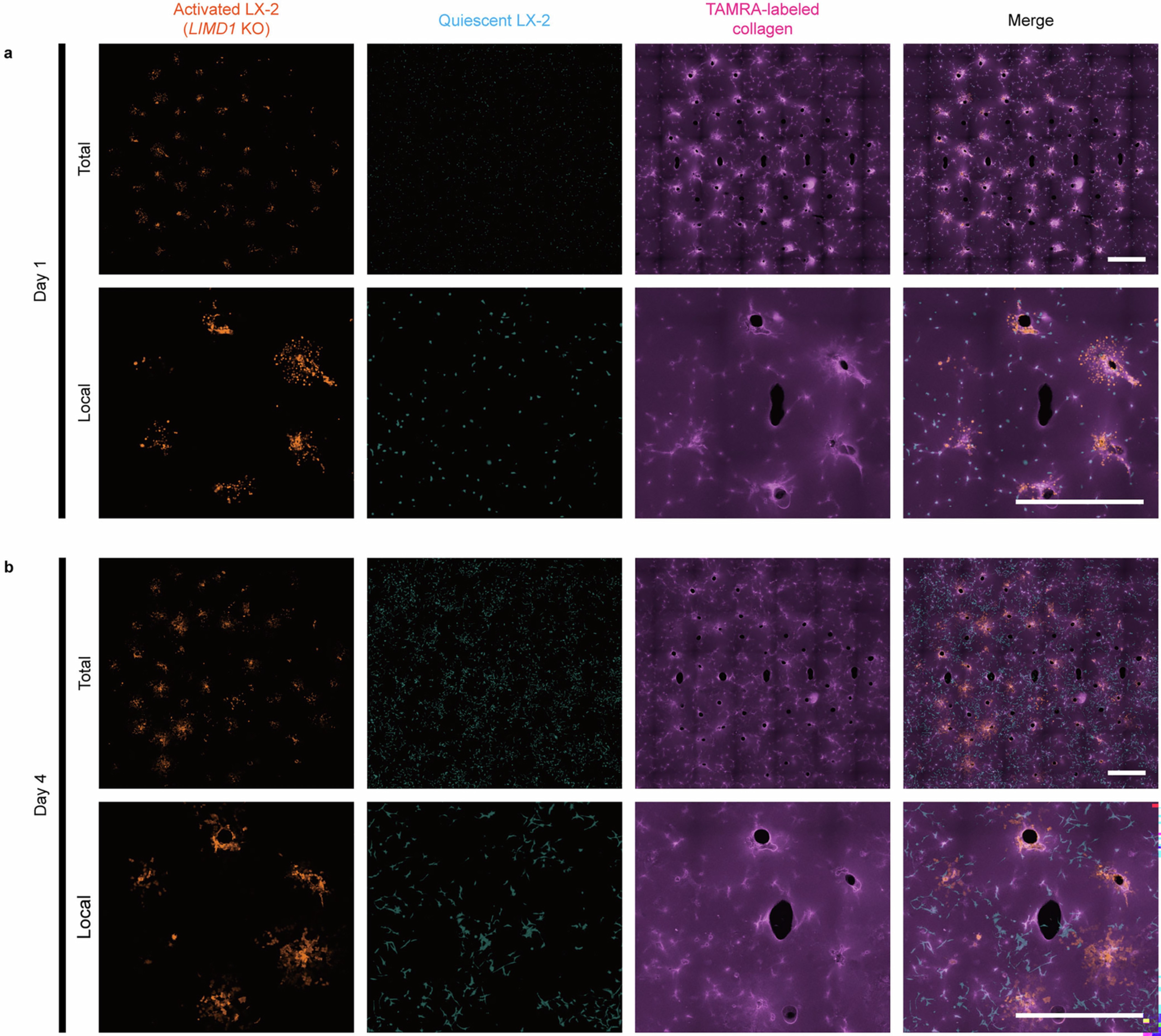 Extended Data Fig. 9: The in vitro model of liver fibrosis constructed using activated LX-2s (LIMD1 KO) and quiescent WT LX-2s.