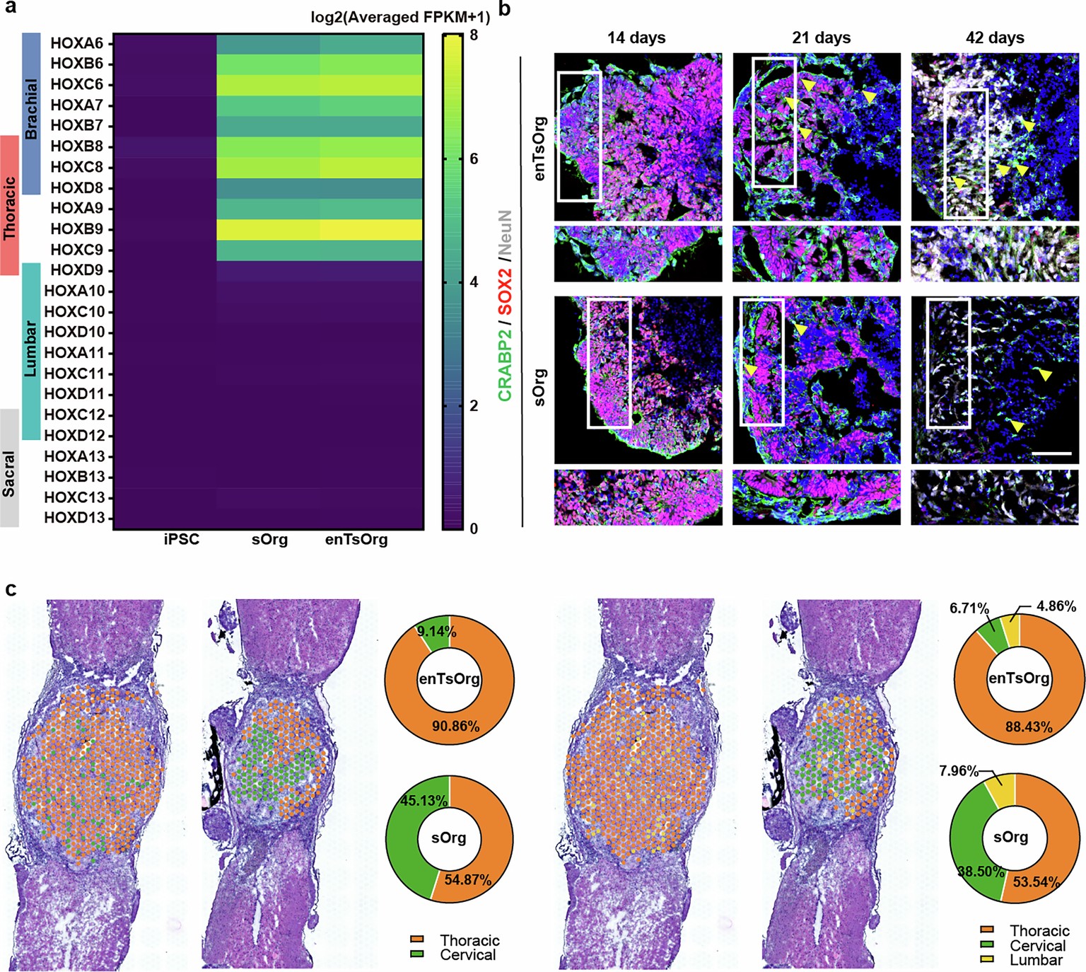 Extended Data Fig. 6: The enTsOrg demonstrates developmental patterns characterized by thoracic spinal segment.
