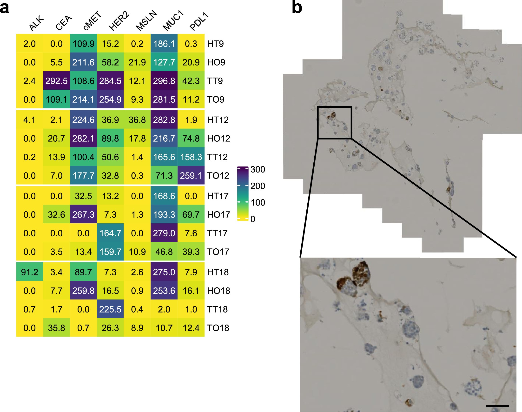 Extended Data Fig. 6: Tumour-associated antigen (TAA) screening in patient samples.