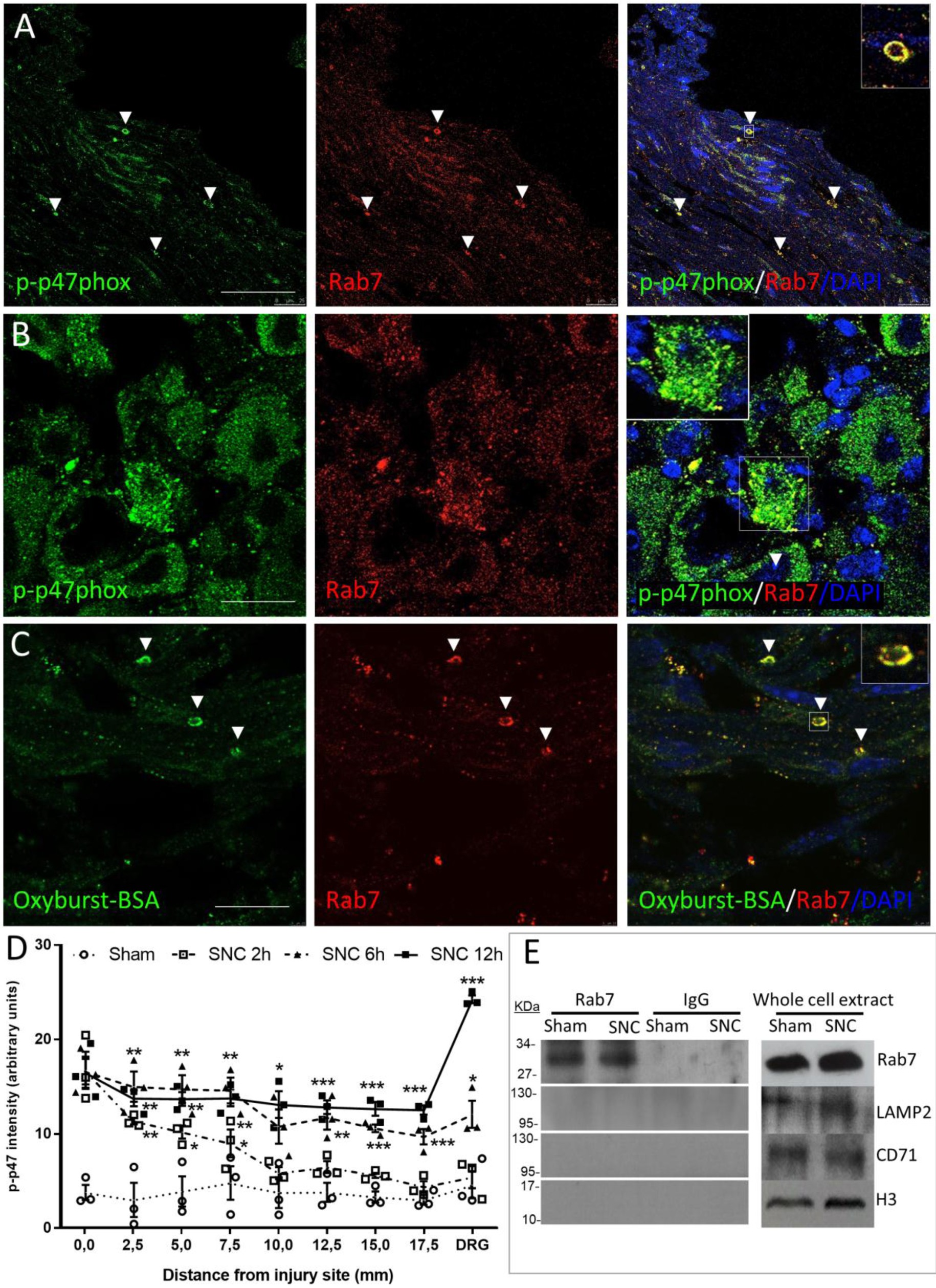 Supplementary Figure 8: Ncf1/p47phox and ROS are present in Rab7+ endosomes after injury in the sciatic nerve and in the DRG.