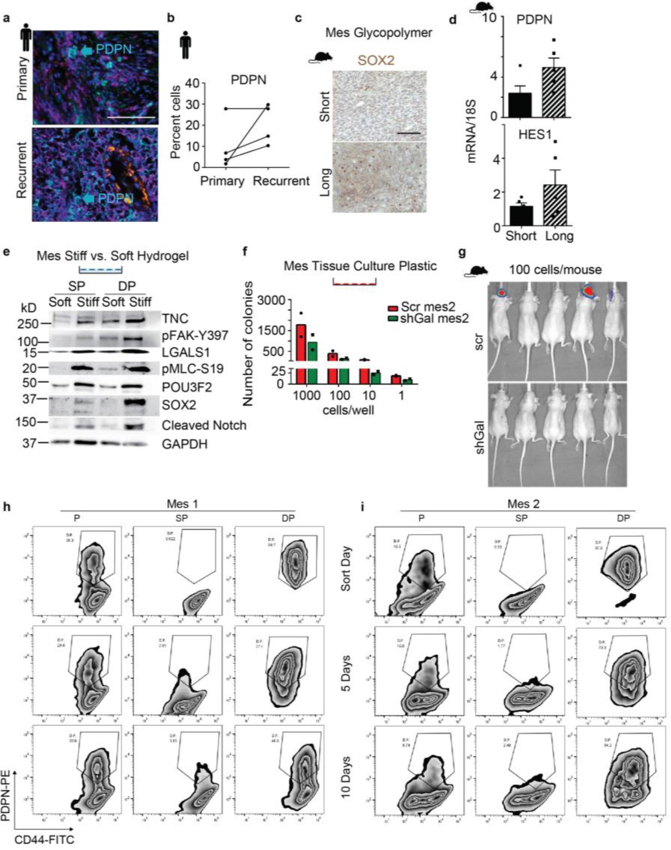 Supplementary Figure 6: A bulky glycocalyx promotes a stem-like phenotype in mesenchymal GBM.