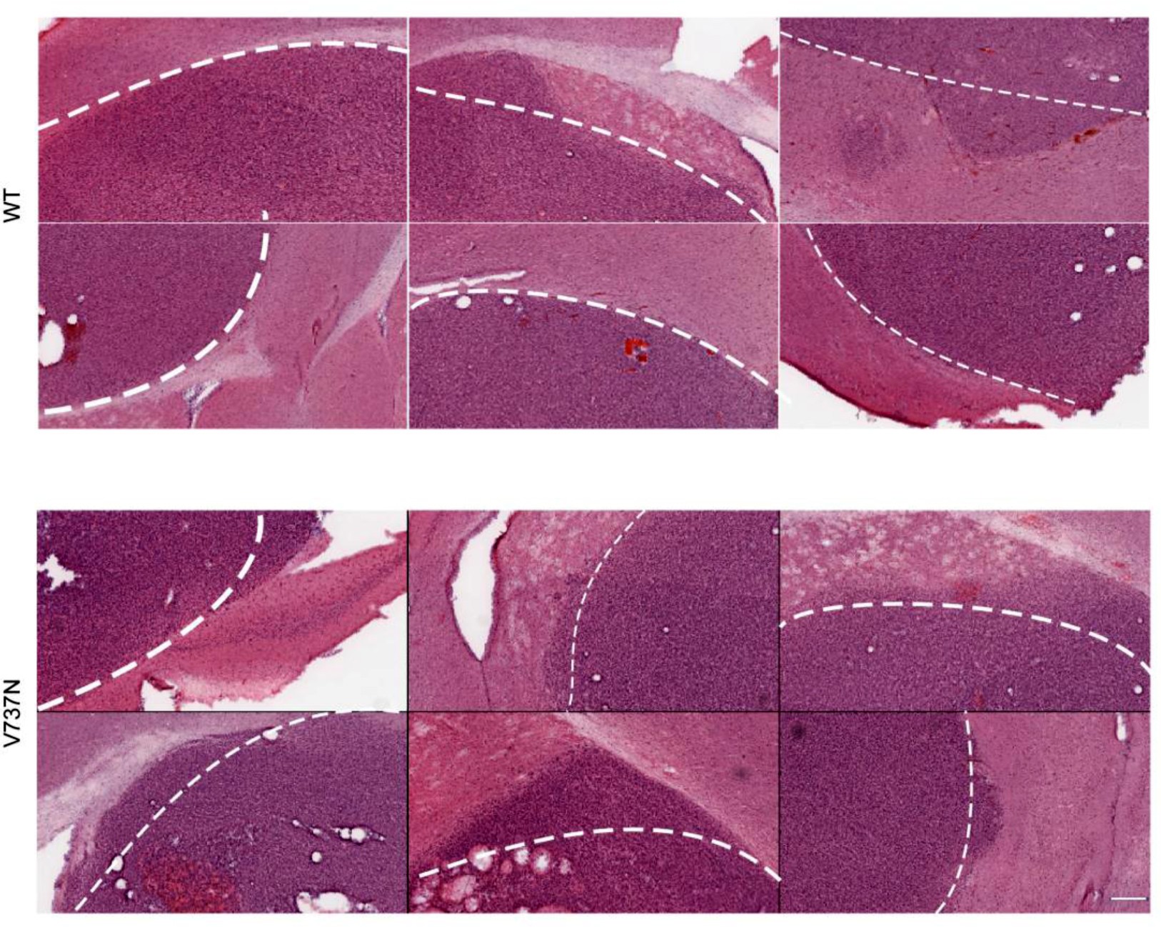 Supplementary Figure 7: Increased local invasion in V737N expressing tumors.