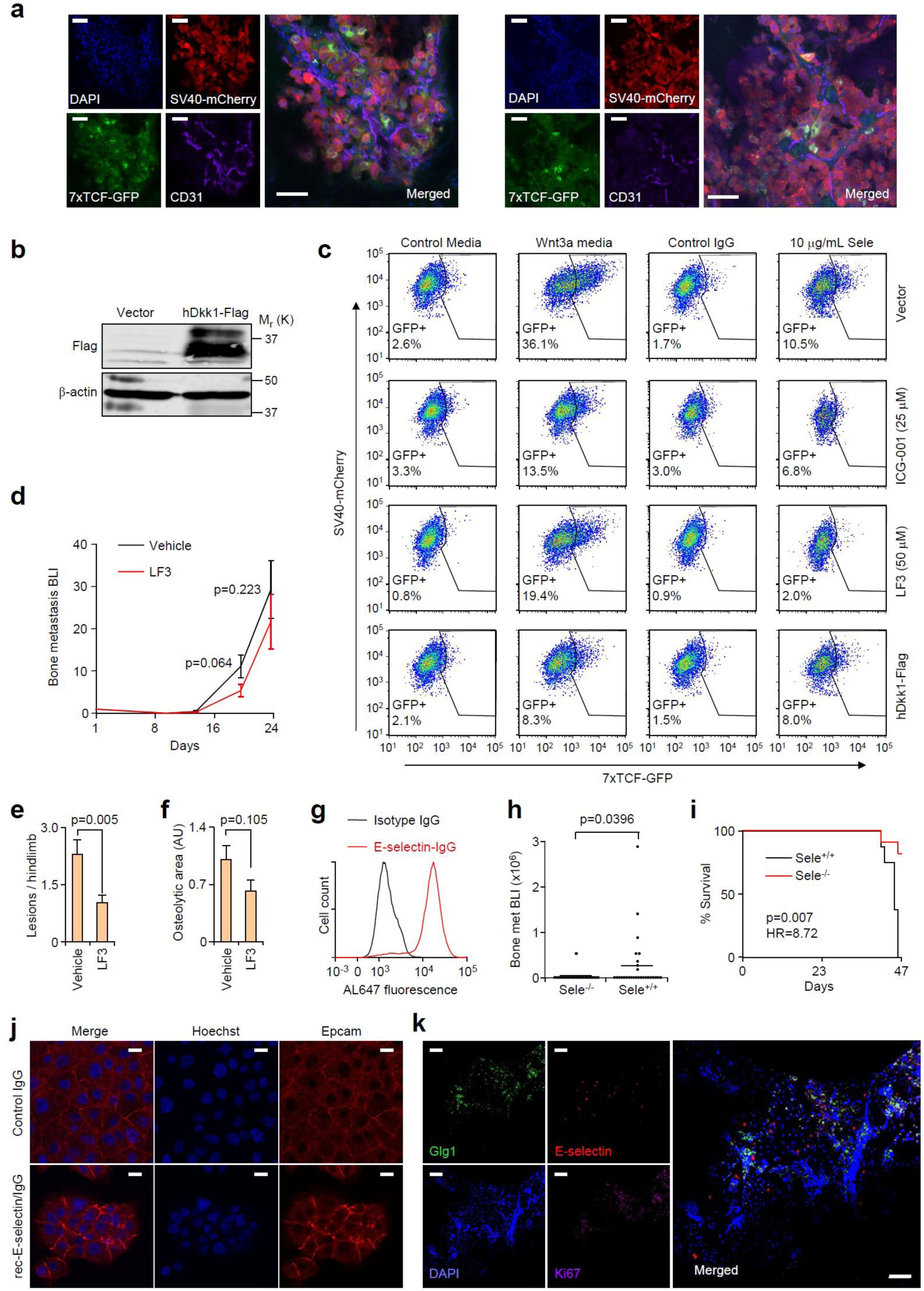 Supplementary Figure 8: E-selectin binding-induced Wnt signalling and E-selectin is critical to prostate cancer bone metastasis.