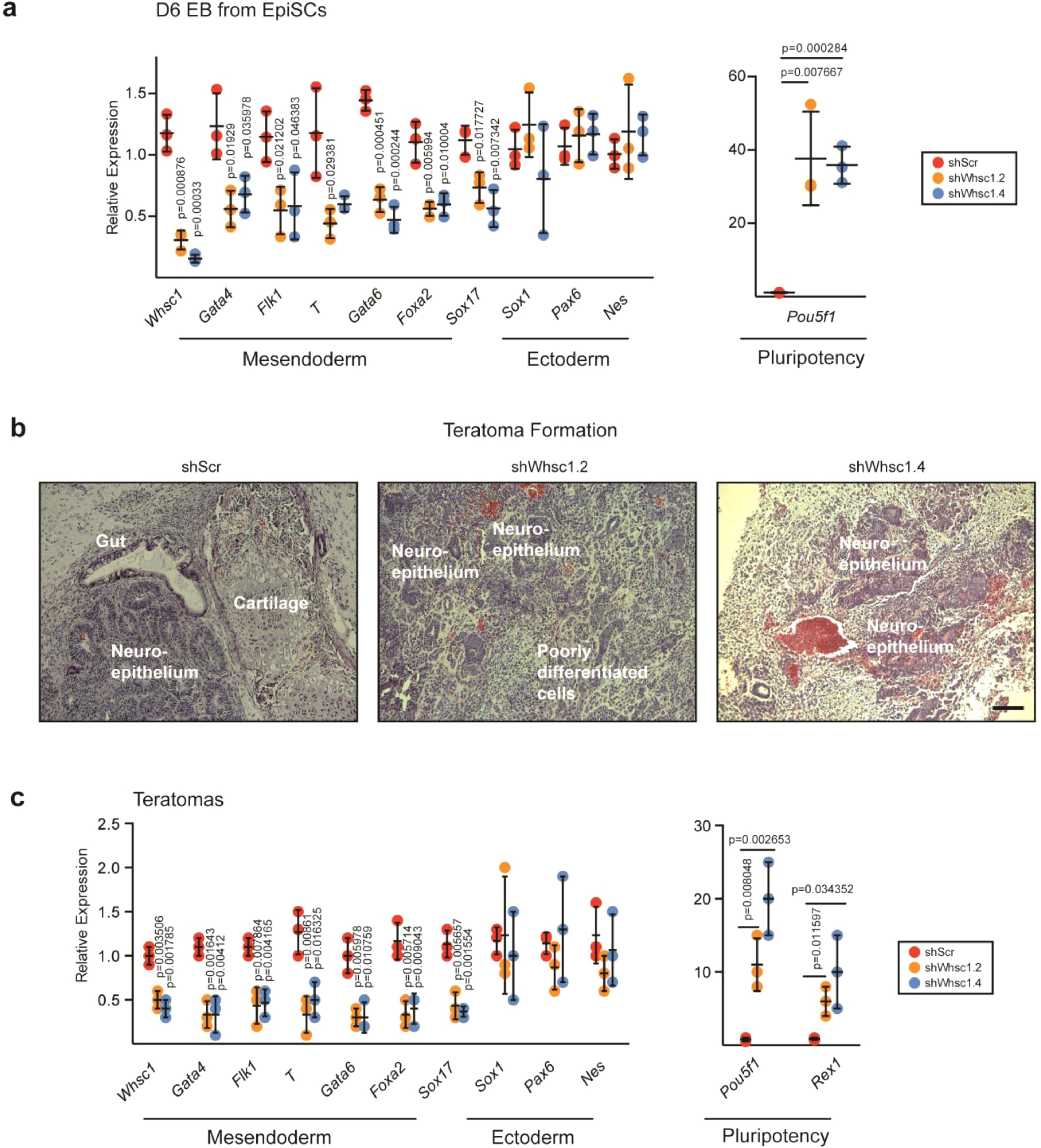 Supplementary Figure 2: Whsc1 depletion results in reduced mesendoderm differentiation in EpiSCs and in teratomas in vivo.
