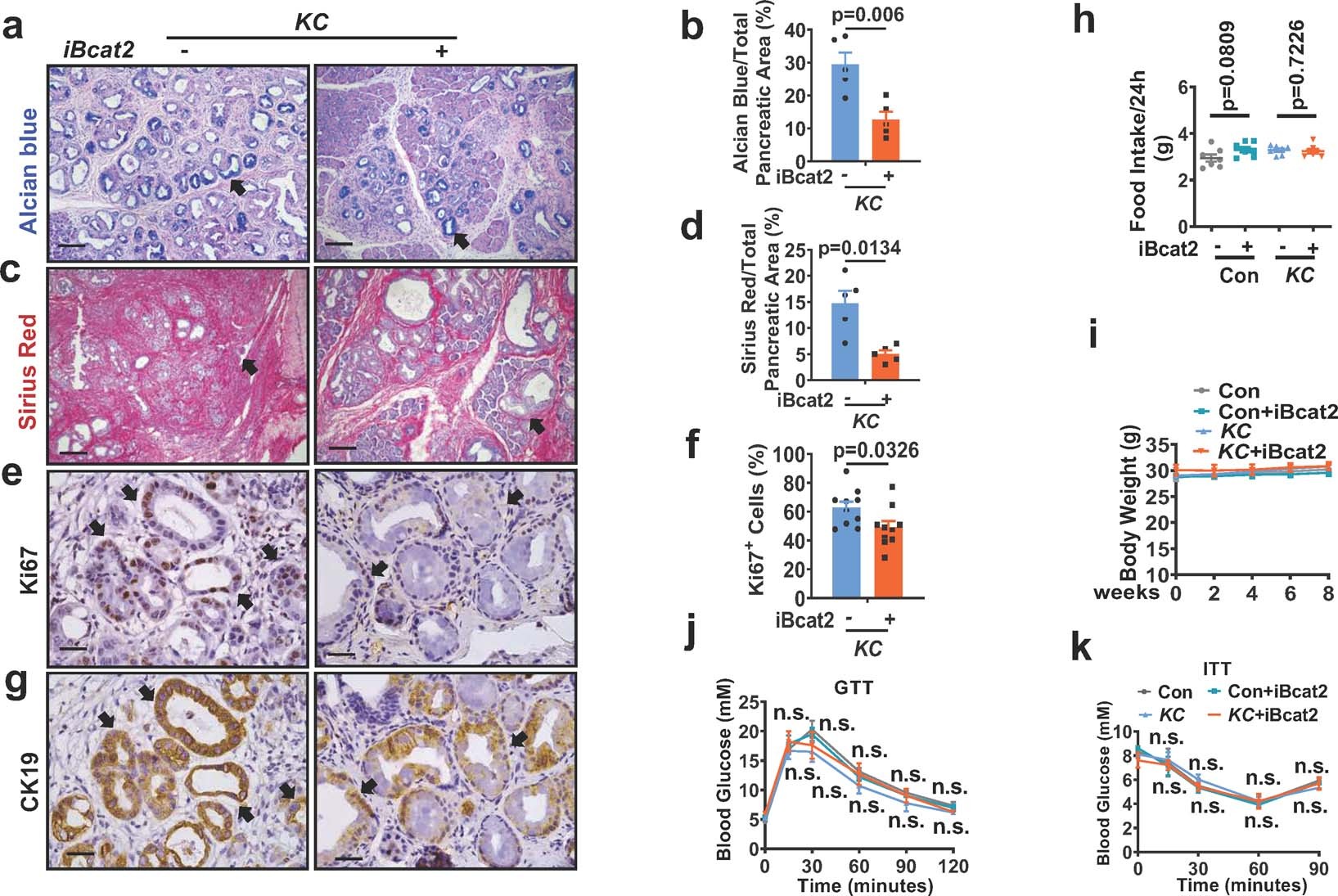 Extended Data Fig. 8: Bcat2 inhibitor impedes PDAC development.
