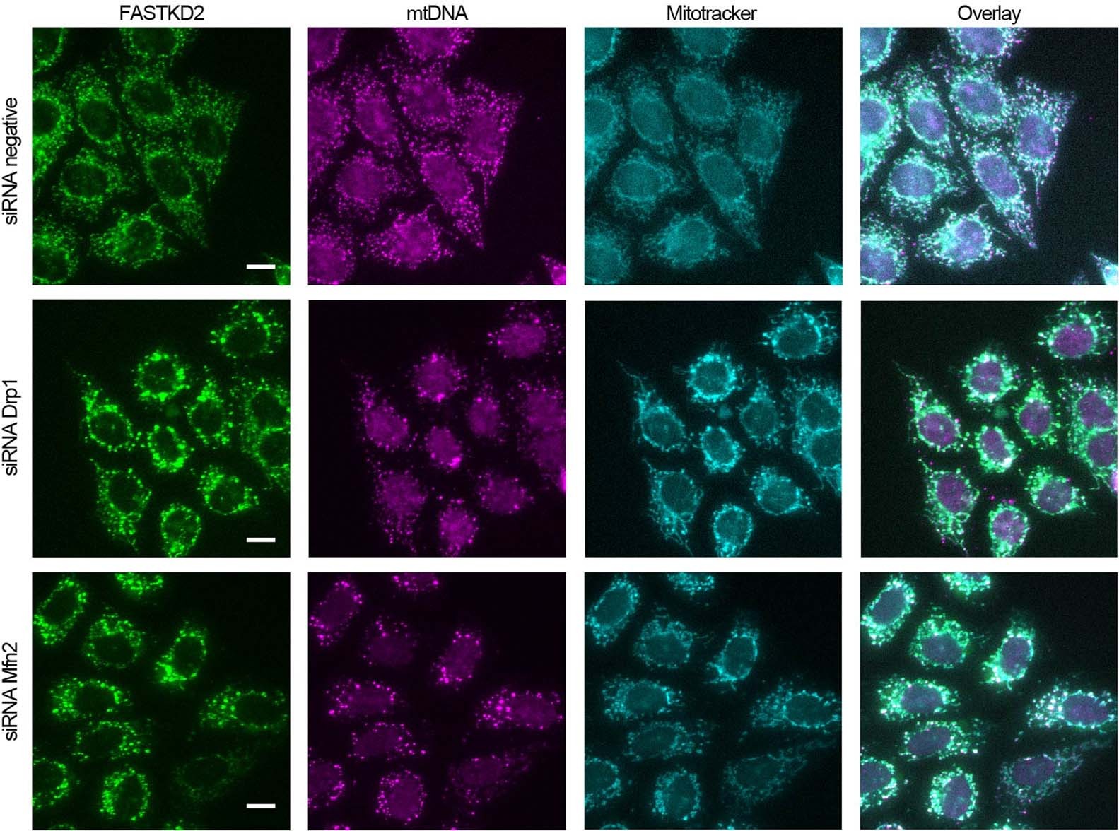 Extended Data Fig. 7: Effect of perturbations to mitochondrial dynamics on MRG distribution.