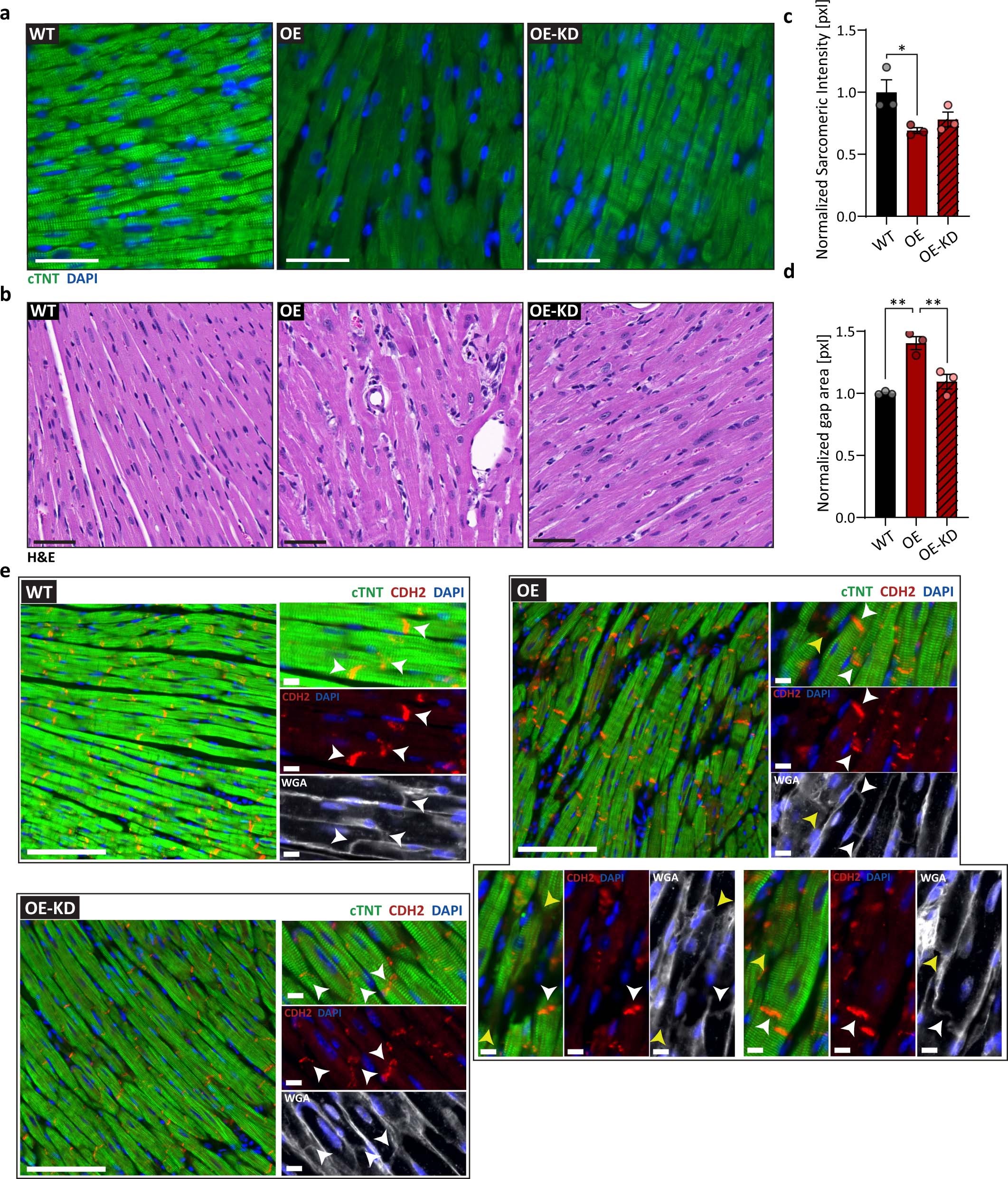 Extended Data Fig. 3: ERBB2 activation results in reduced CM connectivity and sarcomeric organization, partially depending on YAP.