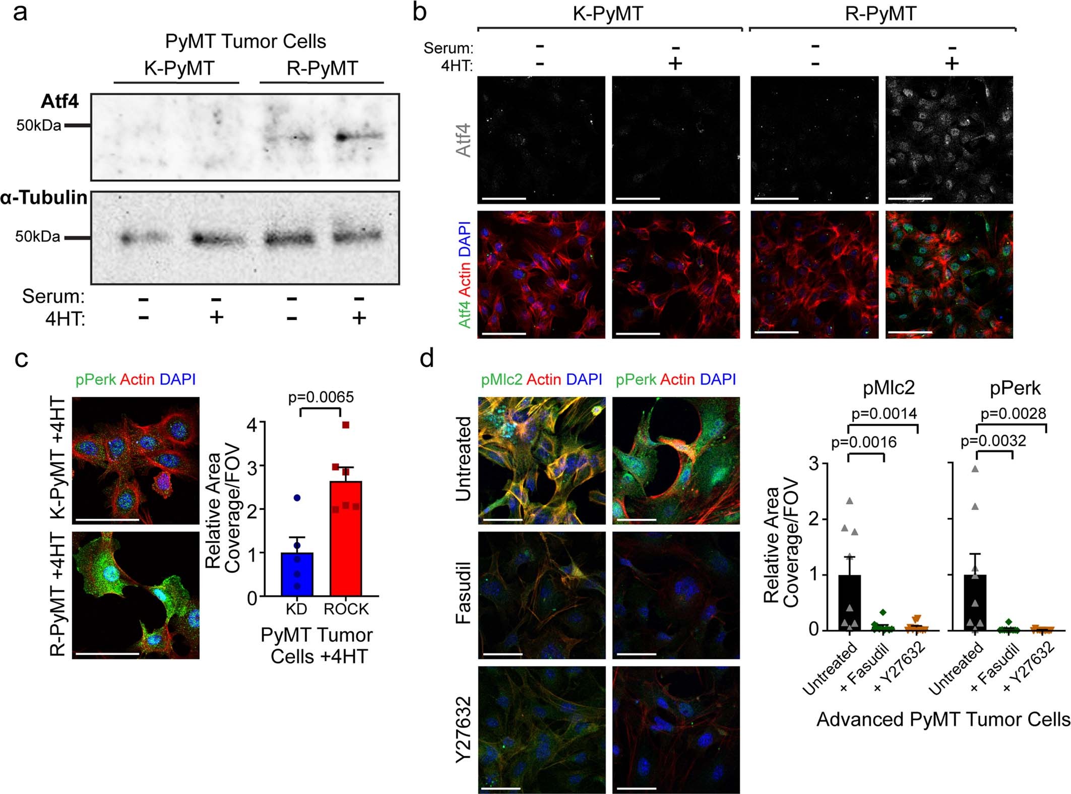 Extended Data Fig. 4: Perk is selectively activated downstream of ROCK in mammary cancer; Related to Fig. 4.