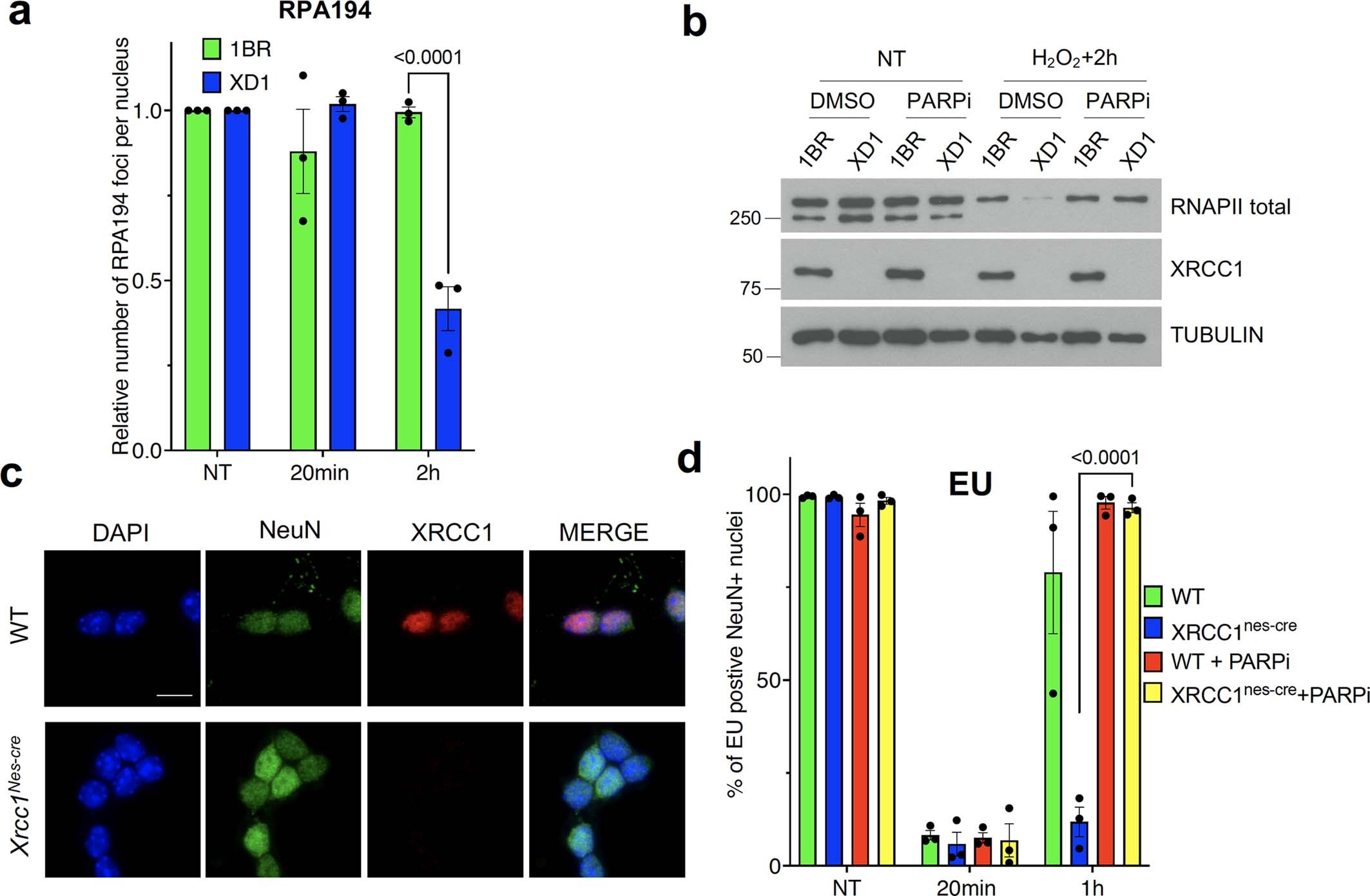 Extended Data Fig. 4: Toxic PARP1 activity suppresses transcriptional recovery in XRCC1 patient fibroblasts and Xrcc1-deficient mouse cerebellar neurons.