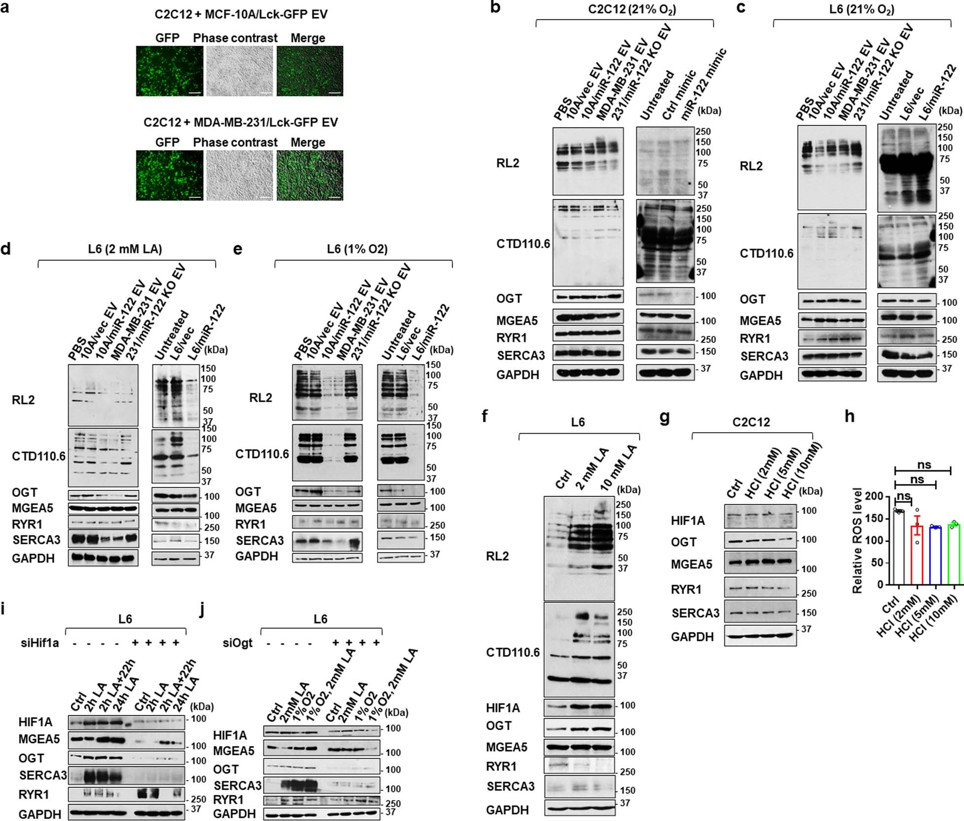 Extended Data Fig. 5: miR-122 regulates O-GlcNAcylation in myotubes in the presence of LA or under hypoxia in an HIF1A-dependent manner.