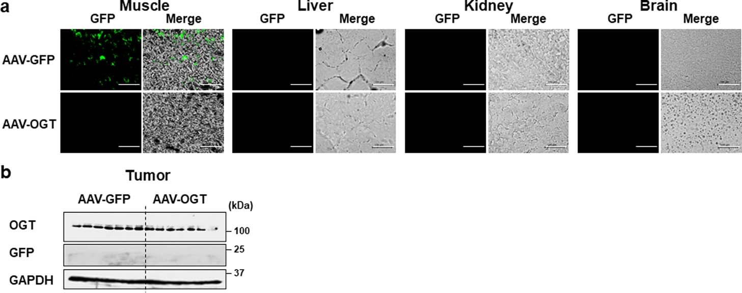 Extended Data Fig. 7: AAV-delivered gene expression in various organs.