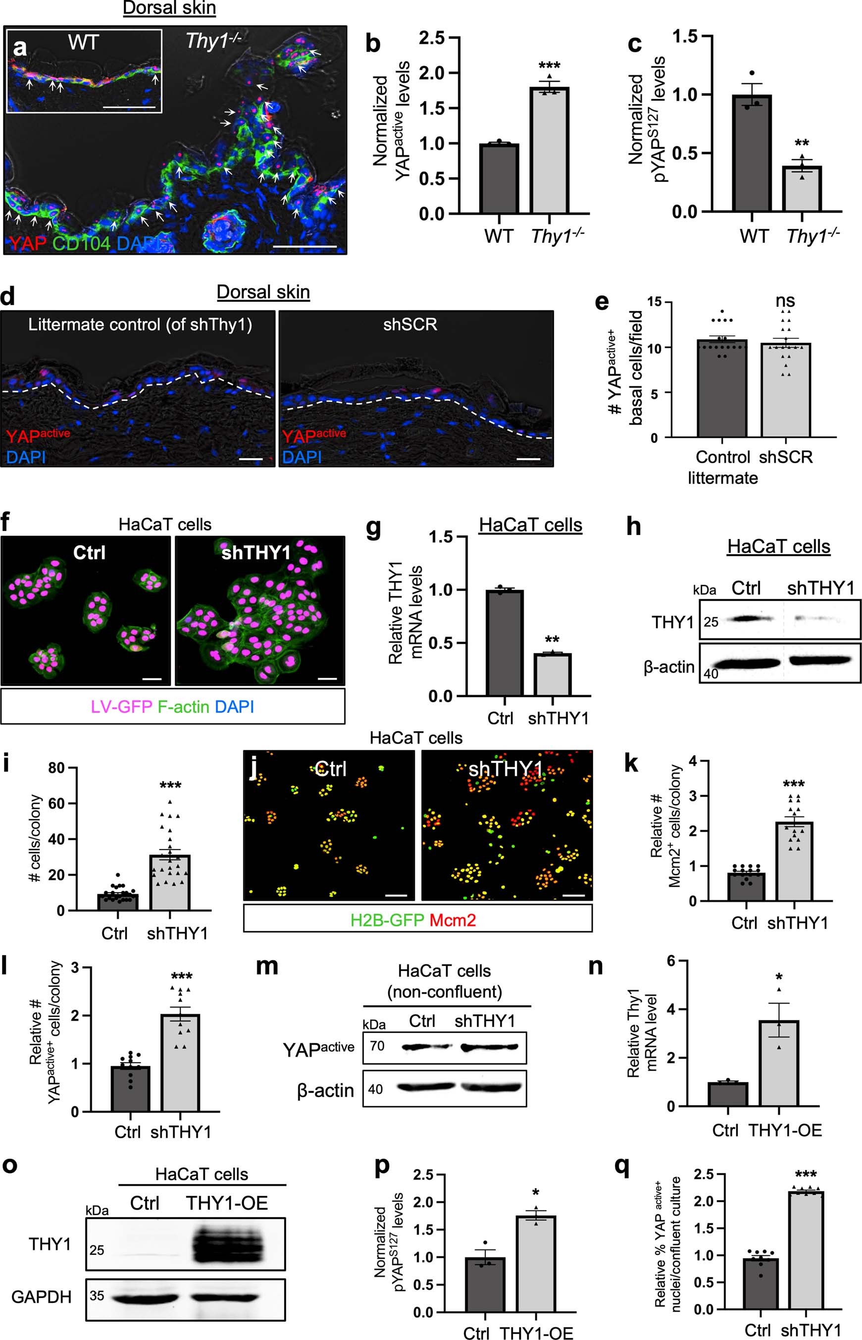 Extended Data Fig. 2: Loss of THY1 leads to enhanced YAP activation.