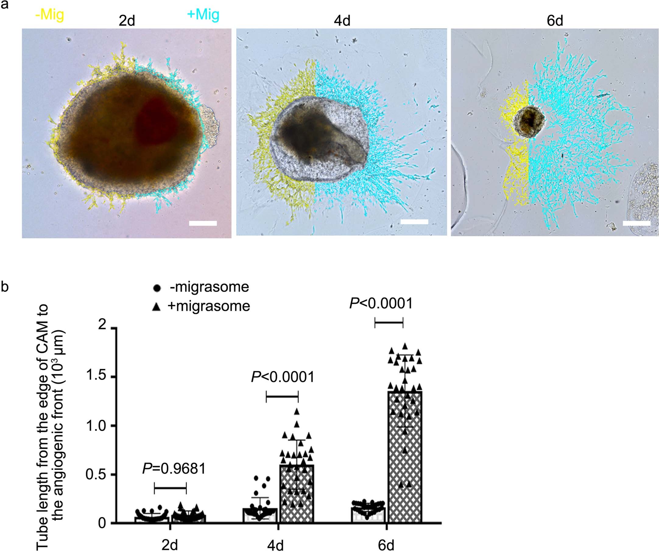 Extended Data Fig. 5: Migrasome delivery promotes EC proliferation and sprouting.