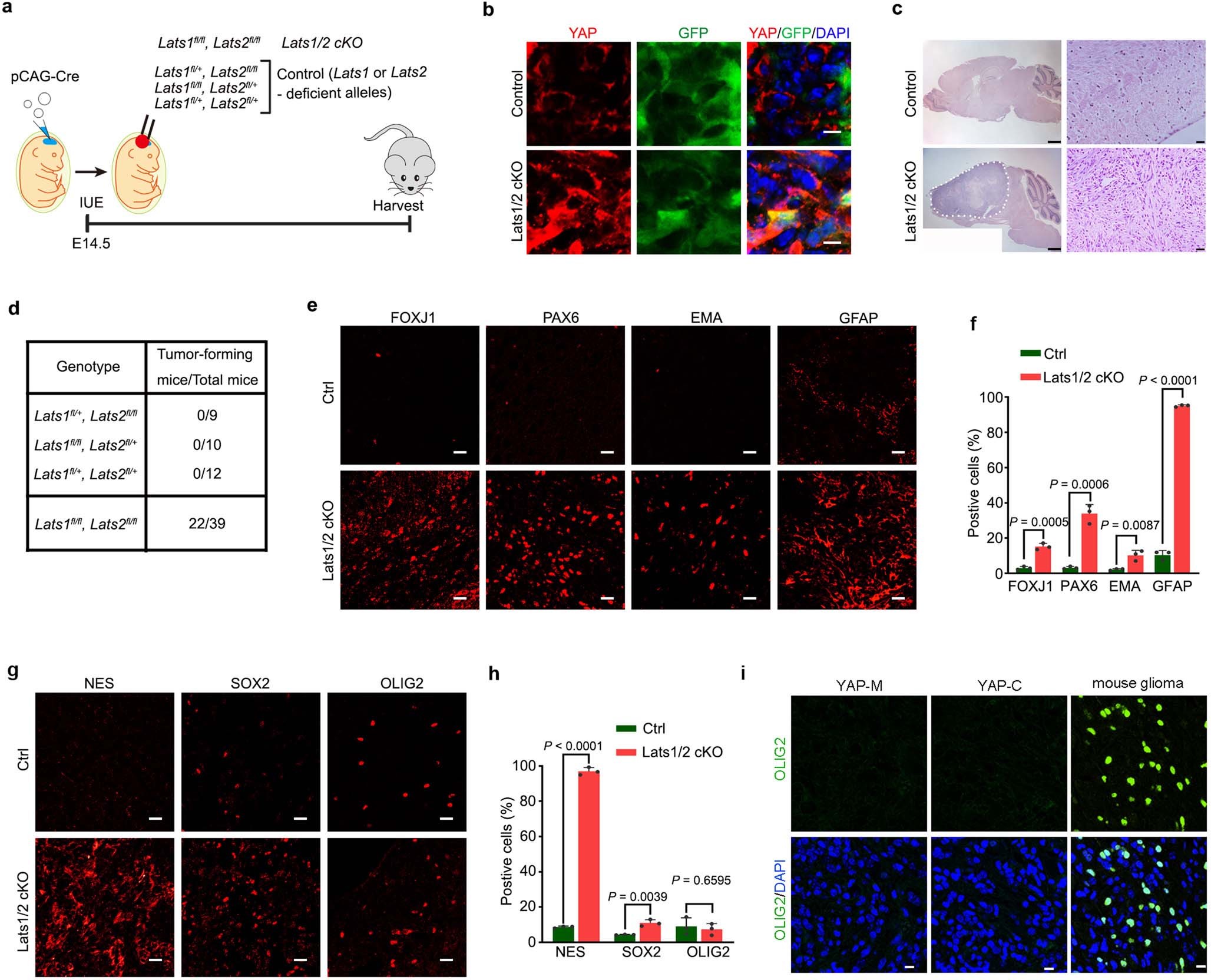 Extended Data Fig. 2: Activation of HIPPO-YAP/TAZ leads to ependymoma in mice.