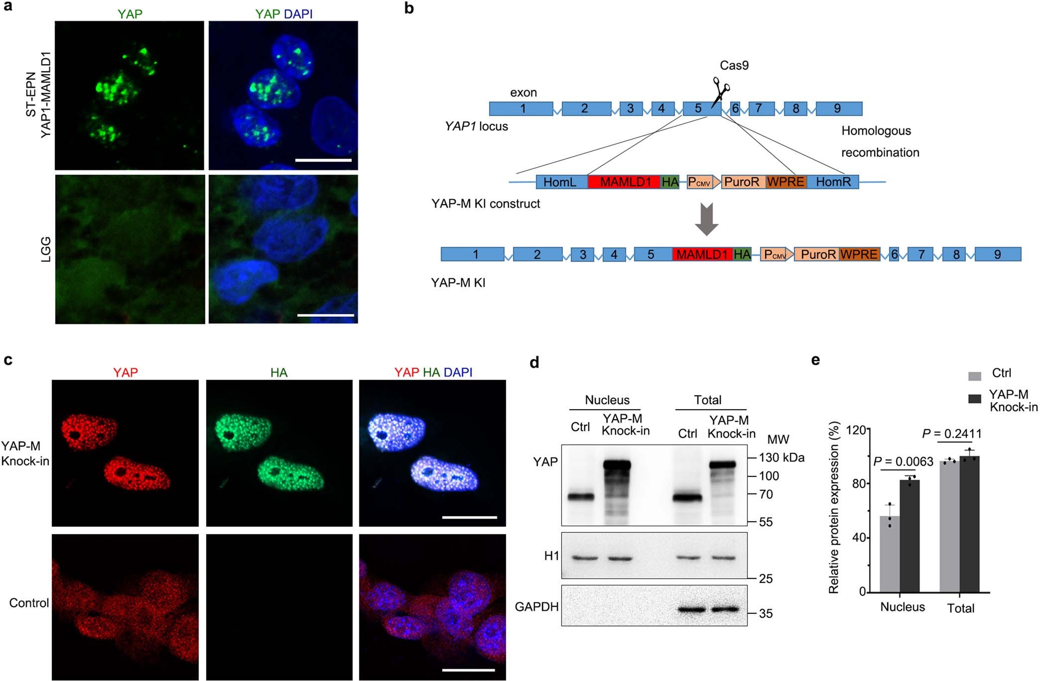 Extended Data Fig. 5: Endogenous YAP-MAMLD1 proteins undergo phase separation.