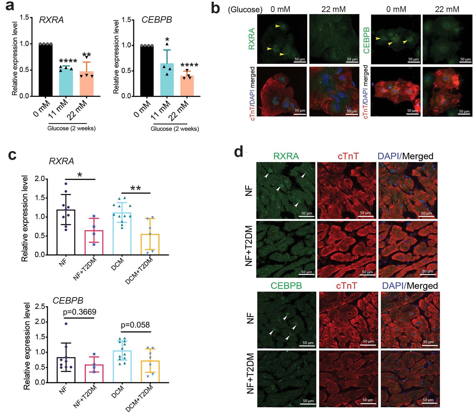 Extended Data Fig. 6: Transcriptional control of LIPTER in human CMs.