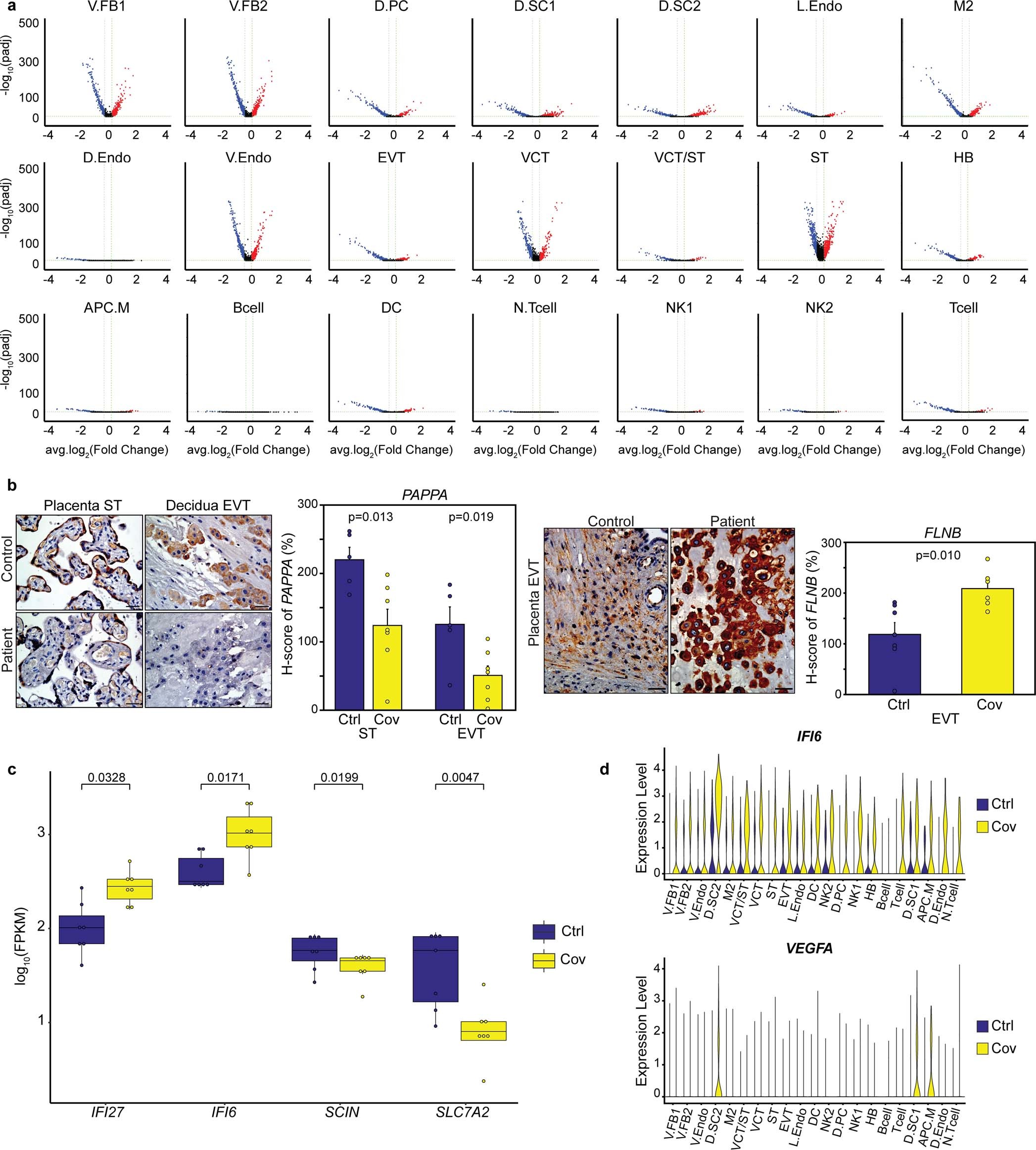Extended Data Fig. 3: Characterization of transcriptional changes in patient samples.