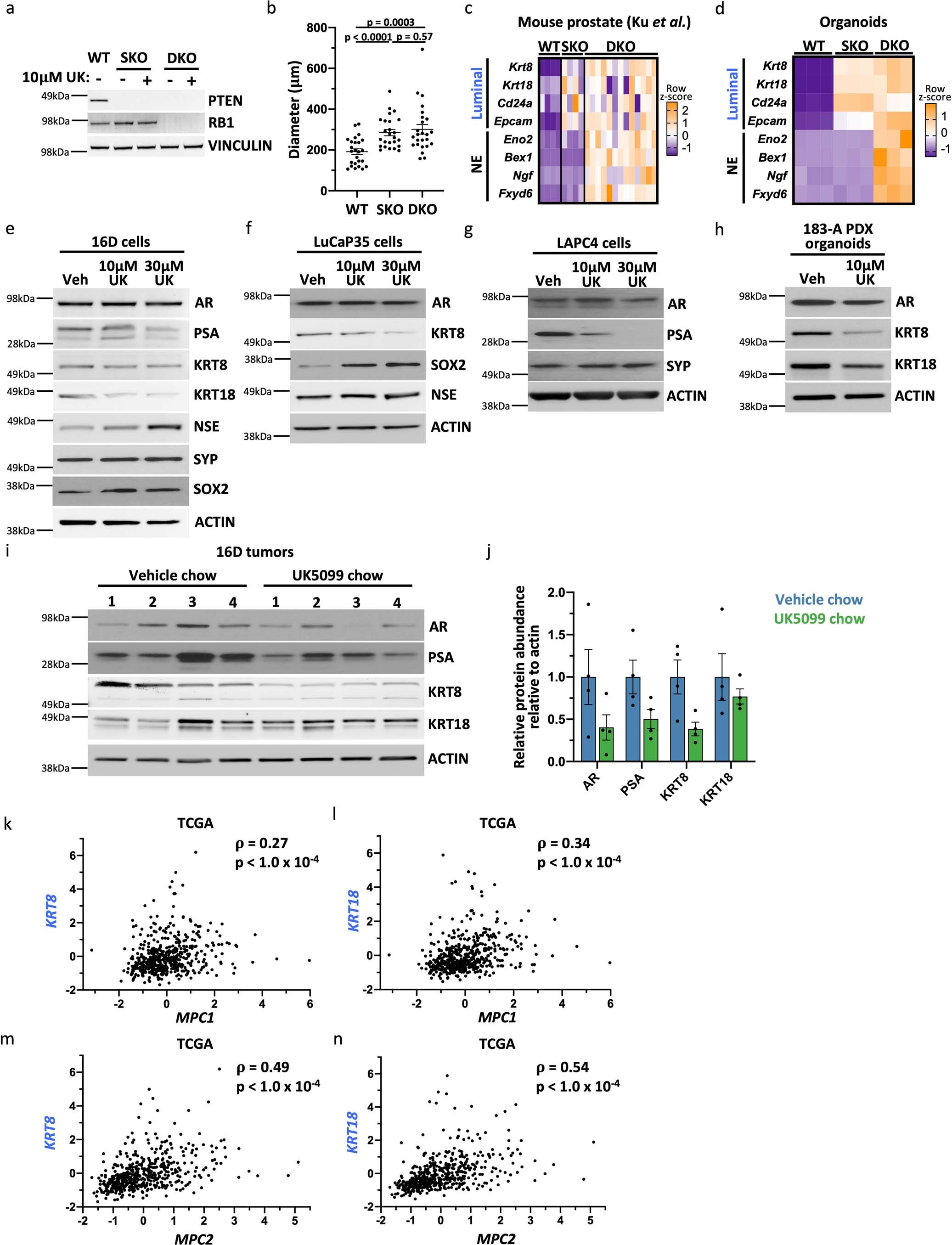 Extended Data Fig. 6: Inhibition of the mitochondrial pyruvate carrier antagonizes luminal lineage identity in models of prostate cancer.
