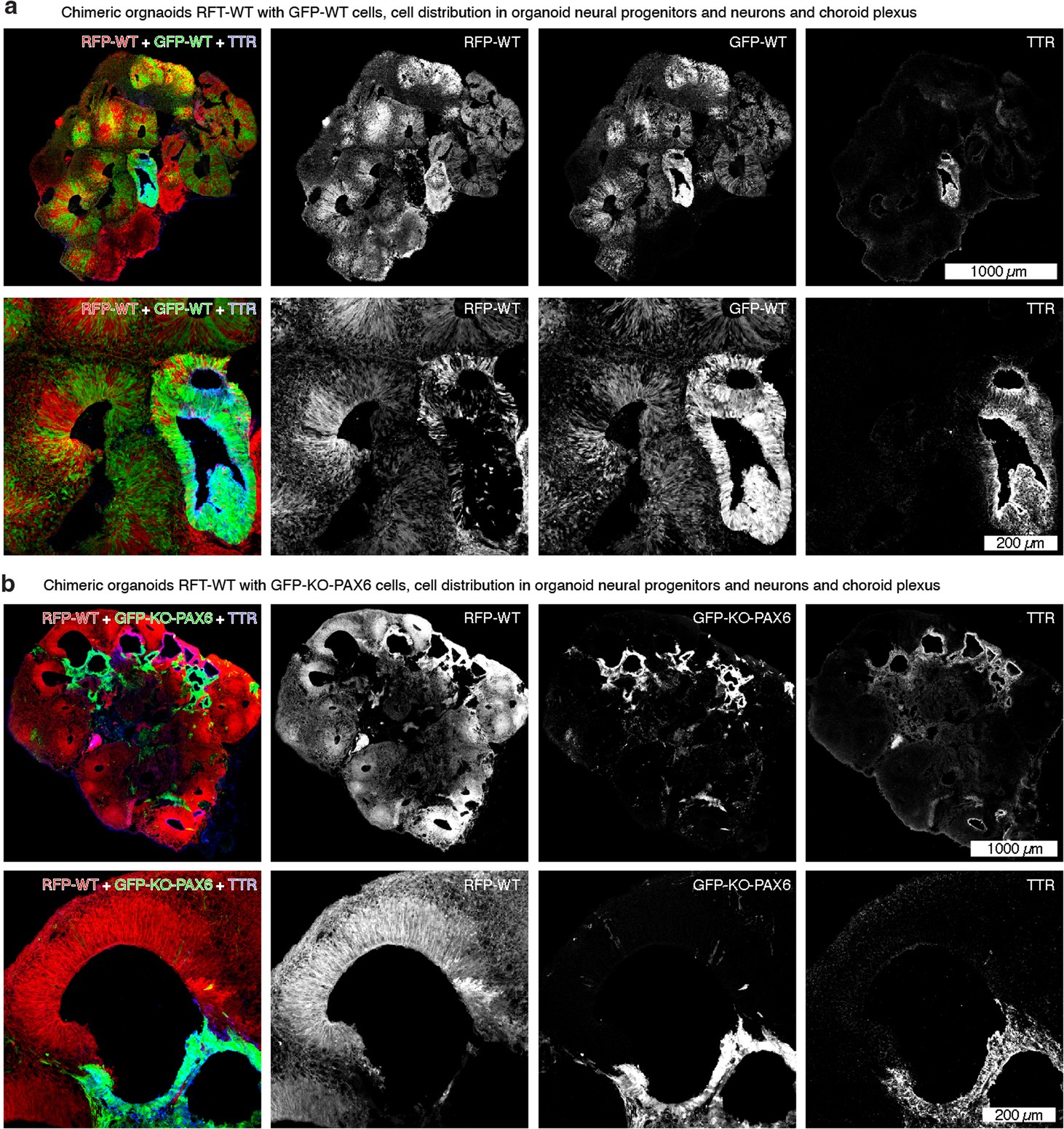 Extended Data Fig. 10: Immunofluorescent characterization of RFP-WT-GFP-WT and RFP-WT-GFP-KO-PAX6 chimeric organoids.