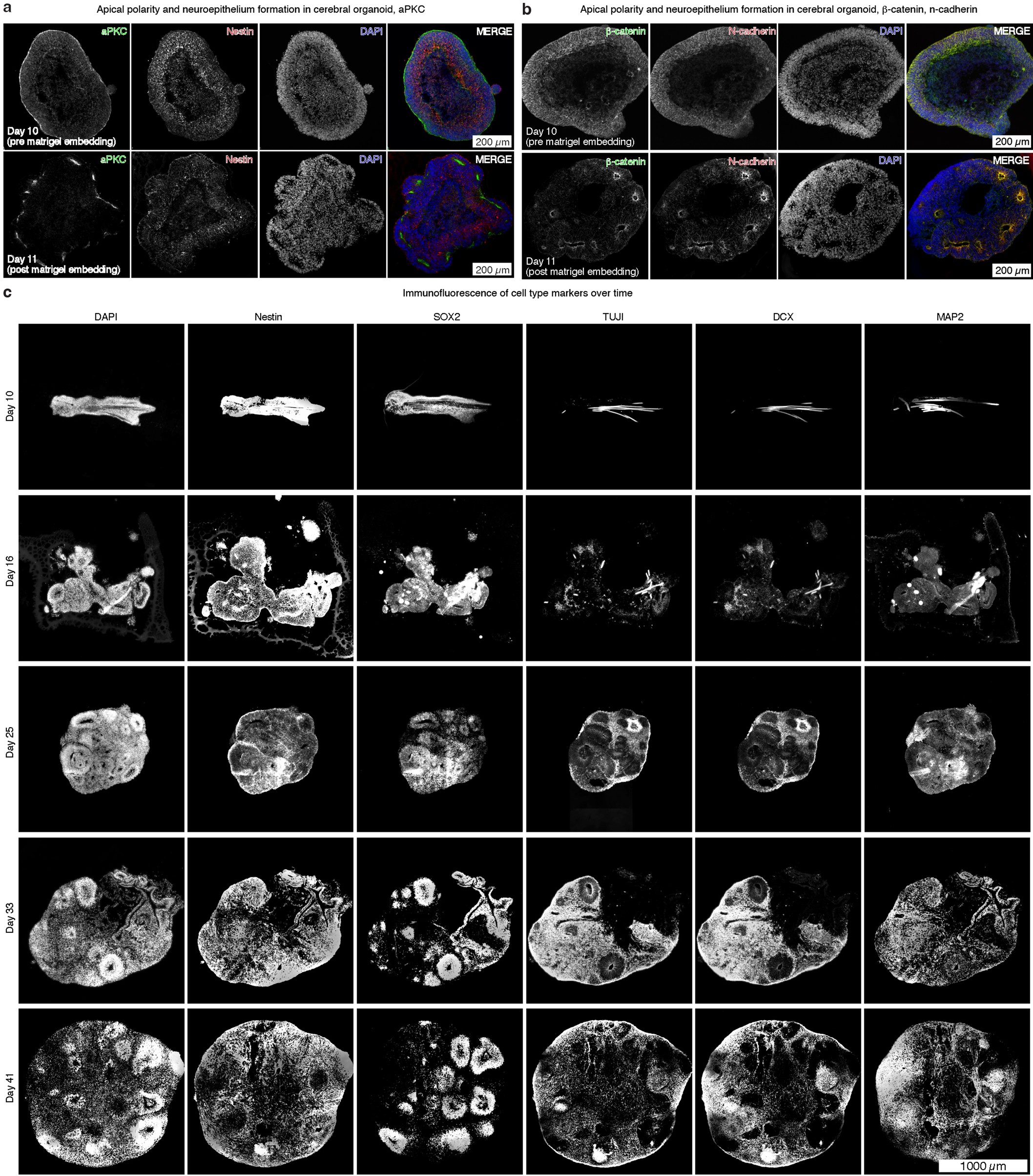 Extended Data Fig. 4: Timing of neuroepithelium formation at day 11 in cerebral organoids and immunofluorescent characterization of organoid cell composition over time.
