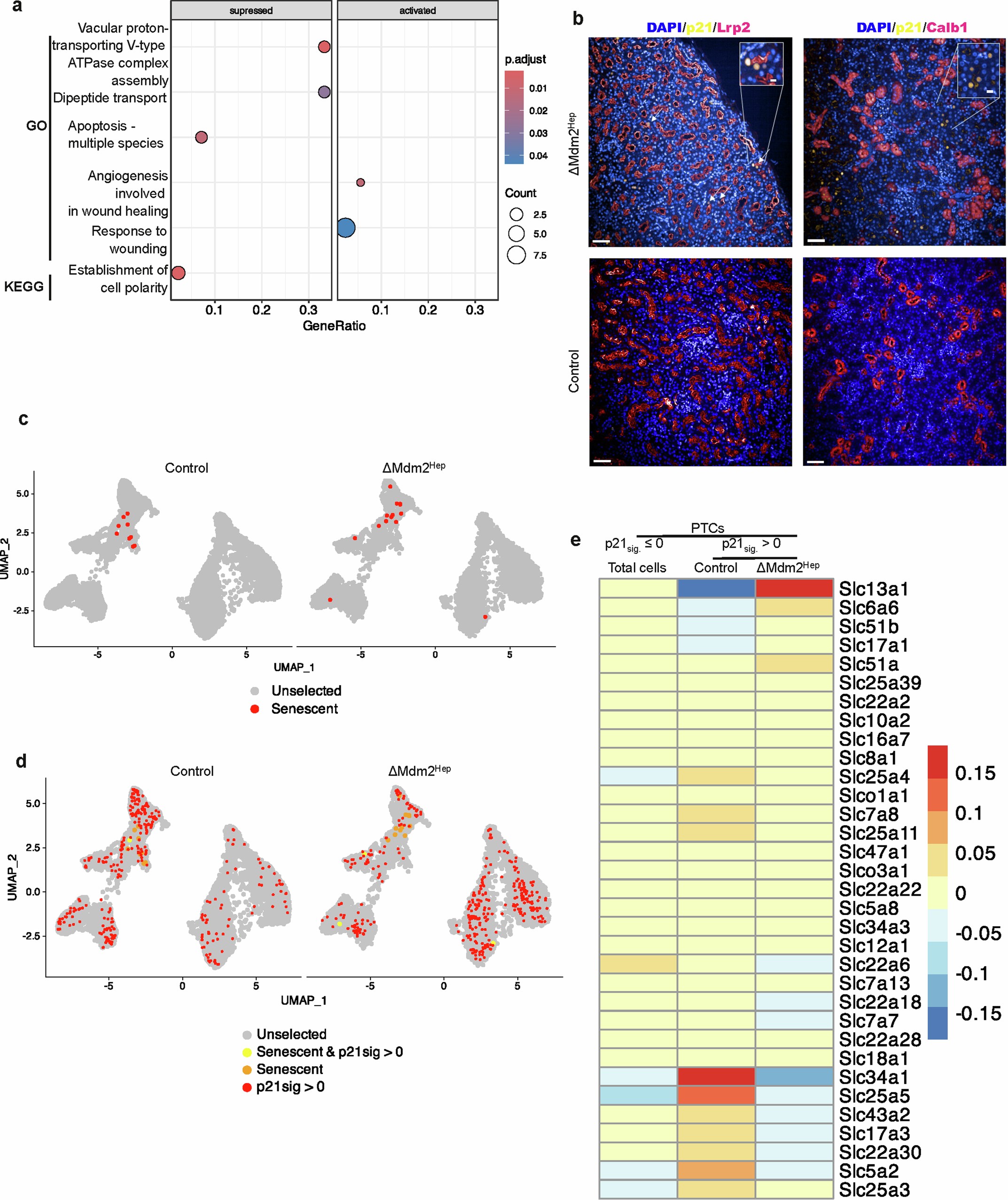Extended Data Fig. 6: Liver senescence results in transcriptional changes in the renal proximal tubular cell compartment.