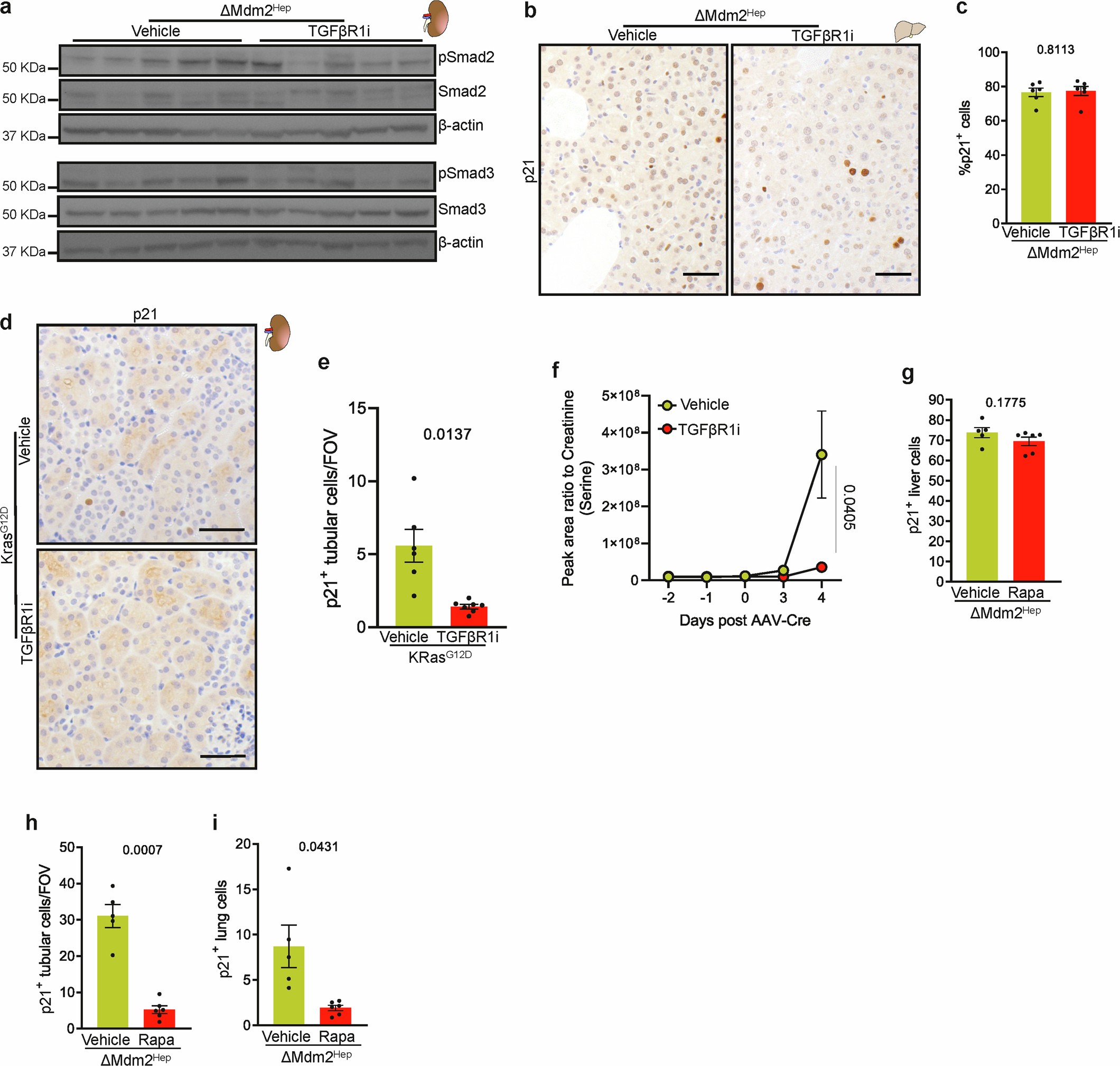 Extended Data Fig. 8: Systemic inhibition of the TGFβ signalling pathway does not affect liver senescence; see experimental schematic in Fig. 5a.