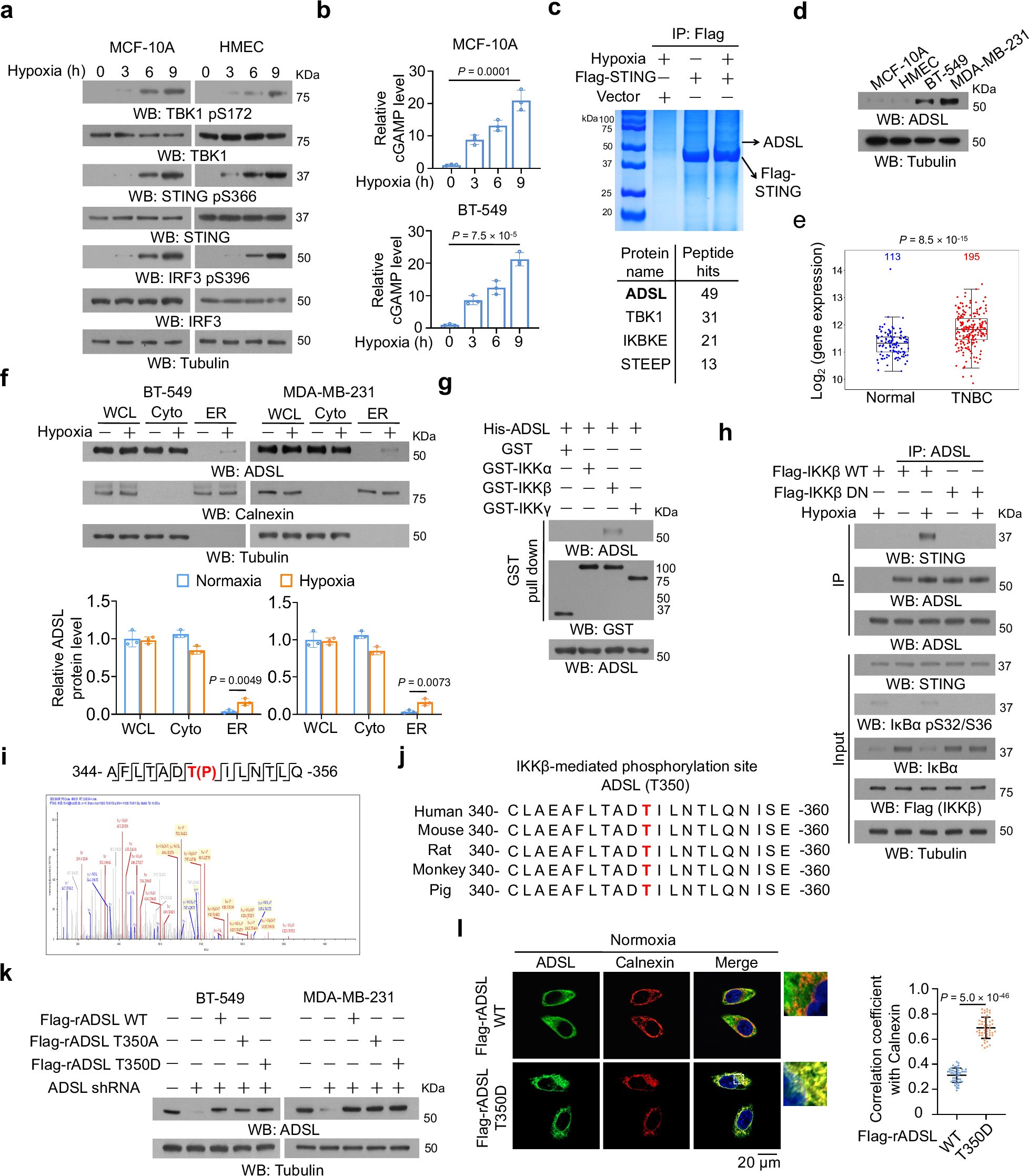 Extended Data Fig. 1: Highly expressed ADSL in breast cancer cells interacts with and inhibits STING activation in an IKKβ-dependent manner.